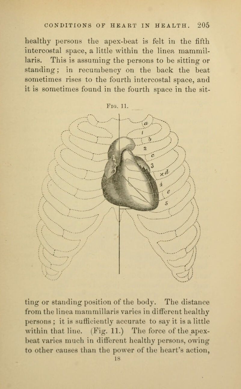 healthy persons the apex-beat is felt in the fifth intercostal space, a little within the linea mammil- laris. This is assuming the persons to be sitting or standing; in recumbency on the back the beat sometimes rises to the fourth intercostal space, and it is sometimes found in the fourth space in the sit- FlG. 11. ting or standing position of the body. The distance from the linea niaiuniillaris varies in different healthy persons; it is sufficiently accurate tosayit is a little within that line. (Fig. 11.) The force of the japex- beal varies much in different healthy persons, owing to Other causes than the power of the heart's action, is