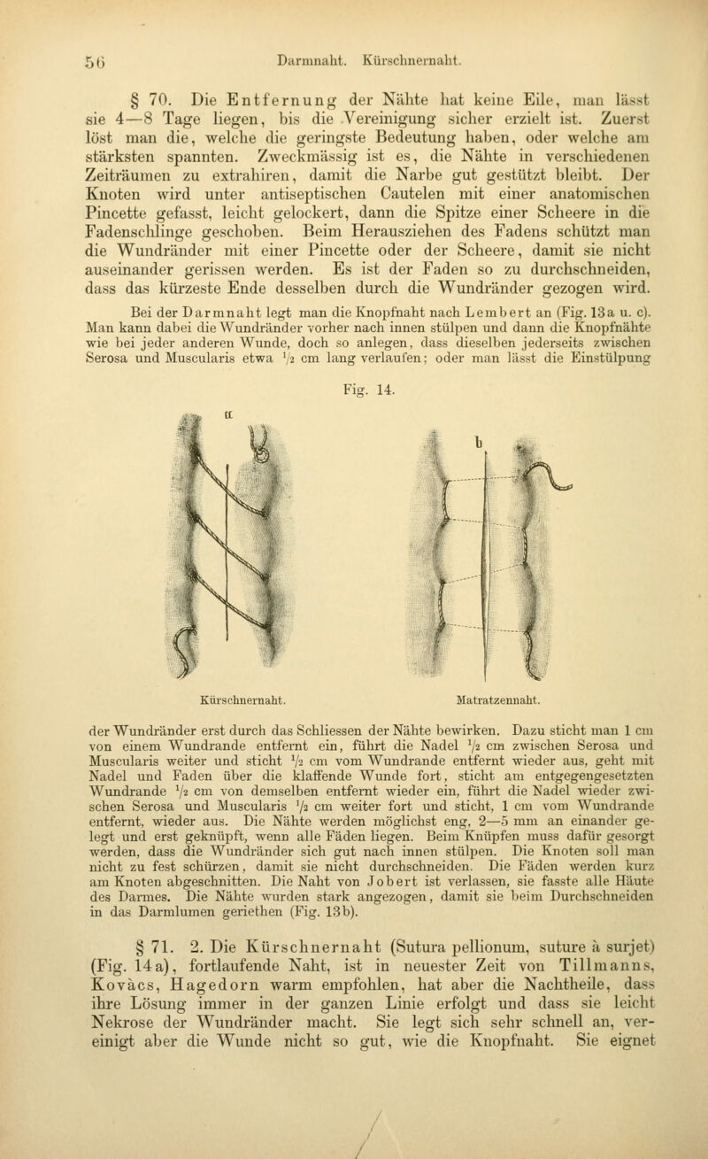 § 70. Die Entfernung der Nähte hat keine Eile, man lässt sie 4—8 Tage liegen, bis die .Vereinigung sicher erzielt ist. Zuerst löst man die, welche die geringste Bedeutung haben, oder welche am stärksten spannten. Zweckmässig ist es, die Nähte in verschiedenen Zeiträumen zu extrahiren, damit die Narbe gut gestützt bleibt. Der Knoten wird unter antiseptischen Cautelen mit einer anatomischen Pincette gefasst, leicht gelockert, dann die Spitze einer Scheere in die Fadensclilinge geschoben. Beim Herausziehen des Fadens schützt man die Wundränder mit einer Pincette oder der Scheere, damit sie nicht auseinander gerissen werden. Es ist der Faden so zu durchschneiden, dass das kürzeste Ende desselben durch die Wundränder gezogen wird. Bei der Darmnaht legt man die Knopfnaht nach Lembert an (Fig. 13a u. c). Man kann dabei die Wundränder vorher nach innen stülpen und dann die Knopfnähte wie bei jeder anderen Wunde, doch so anlegen, dass dieselben jederseits zwischen Serosa und Muscularis etwa V2 cm lang verlaufen; oder man lässt die Einstülpung Ficr. 14. Kürschiiernaht. Matratzennaht. der Wundränder erst durch das Schliessen der Nähte bewirken. Dazu sticht man 1 cm von einem Wundrande entfernt ein, führt die Nadel V2 cua zwischen Serosa und Muscularis weiter und sticht V2 cm vom Wundrande entfernt wieder aus, geht mit Nadel und Faden über die klaffende Wunde fox-t, sticht am entgegengesetzten Wundrande 7^ cm von demselben entfernt wieder ein, führt die Nadel wieder zwi- schen Serosa und Muscularis ^2 cm weiter fort und sticht, 1 cm vom Wundrande entfernt, wieder aus. Die Nähte werden möglichst eng, 2—5 mm an einander ge- legt und erst geknüpft, wenn alle Fäden liegen. Beim Knüpfen muss dafür gesorgt werden, dass die Wundränder sich gut nach innen stülpen. Die Knoten soll man nicht zu fest schürzen, damit sie nicht durchschneiden. Die Fäden werden kurz am Knoten abgeschnitten. Die Naht von Jobert ist verlassen, sie fasste alle Häute des Darmes. Die Nähte wurden stark angezogen, damit sie beim Dui'chschneiden in das Darmlumen geriethen (Fig. 13 b). § 71. 2. Die Kürschnernaht (Sutura pellionum, suture ä, surjet) (Fig. 14a), fortlaufende Naht, ist in neuester Zeit von Tillmanns, Koväcs, Hagedorn warm empfolilen, hat aber die Nachtheile, dass ihre Lösung immer in der ganzen Linie erfolgt und dass sie leicht Nekrose der Wundränder macht. Sie legt sich sehr schnell an, ver- einigt aber die Wunde nicht so gut, wie die Knopfuaht. Sie eignet /