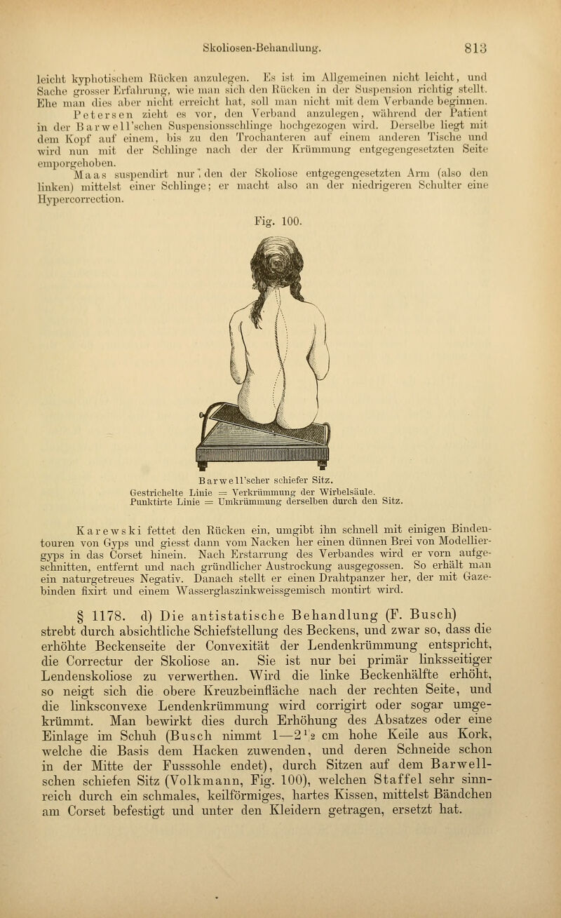 leicht kypliotiscbein Rücken anzulegen. Ks ist im Allgemeinen nicht leicht, und Sache grosser Krfalirung, wie man sich den Kücken in der (Suspension richtig stellt. Ehe man dies aber nicht erreicht hat, soll man nicht mit dem Verbände beginnen. Petersen zieht es vor, den Verband anzulegen, während der Patient in der Barwell'schen Suspensionsschlinge hochgezogon wird. Derselbe liegt mit dem Kopf auf einem, bis zu den Trochanteren auf einem anderen Tische und wird nun mit der Schlinge nach der der Krümmung entgegengesetzten Seite emporgehoben. Maas suspendirt nur', den der Skoliose entgegengesetzten Arm (also den linken) mittelst einer Schlinge; er macht also an der niedrigeren Schulter eine Hypercorrection. Fig. 100. Barwell'sclier scliiefer Sitz. Gestrichelte Linie = Verkrümmung der Wirbelsäule. Punktirte Linie = Umkrümmung derselben durch den Sitz. Karewski fettet den Rücken ein, umgibt ihn schnell mit einigen Binden- touren von Gyps und giesst dann vom Nacken her einen dünnen Brei von Modellier- gyps in das Corset hinein. Nach Erstarrung des Verbandes wird er vorn aufge- schnitten, entfernt und nach gründlicher Austrockung ausgegossen. So erhält man ein naturgetreues Negativ. Danach stellt er einen Drahtpanzer her, der mit Gaze- binden fixirt und einem Wasserglaszinkweissgemisch montirt wird. § 1178. d) Die antistatische Beliandlung (F. Buscli) strebt durch absichtliche Schiefstellung des Beckens, und zwar so, dass die erhöhte Beckenseite der Convexität der Lendenkrümmung entspricht, die Correctur der Skoliose an. Sie ist nur bei primär linksseitiger Lendenskoliose zu verwerthen. Wird die linke Beckenhälfte erhöht, so neigt sich die obere Kreuzbeinfläche nach der rechten Seite, und die linksconvexe Lendenkrümmung wird corrigirt oder sogar umge- krümmt. Man bewirkt dies durch Erhöhung des Absatzes oder eine Einlage im Schuh (Busch nimmt 1—2V2 cm hohe Keile aus Kork, welche die Basis dem Hacken zuwenden, und deren Schneide schon in der Mitte der Fusssohle endet), durch Sitzen auf dem Barwell- schen schiefen Sitz (Volkmann, Fig. 100), welchen Staffel sehr sinn- reich durch ein schmales, keilförmiges, hartes Kissen, mittelst Bändchen am Corset befestigt und unter den Kleidern getragen, ersetzt hat.