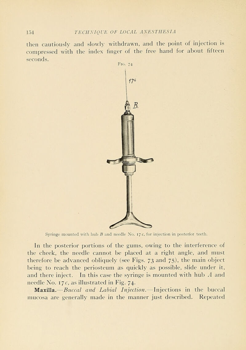 then cautiously and slowly withdrawn, and the point of injection is compressed with the index finger of the free hand for about fifteen seconds. Fig. 74 Syringe mounted with hub B and needle No. 17 c, for injection in posterior teeth In the posterior portions of the gums, owing to the interference of the cheek, the needle cannot be placed at a right angle, and must therefore be advanced obliquely (see Figs. 73 and 75), the main object being to reach the periosteum as quickly as possible, slide under it, and there inject. In this case the syringe is mounted with hub A and needle No. 17 c, as illustrated in Fig. 74. Maxilla.—Buccal and Labial Injection.—Injections in the buccal mucosa are generally made in the manner just described. Repeated