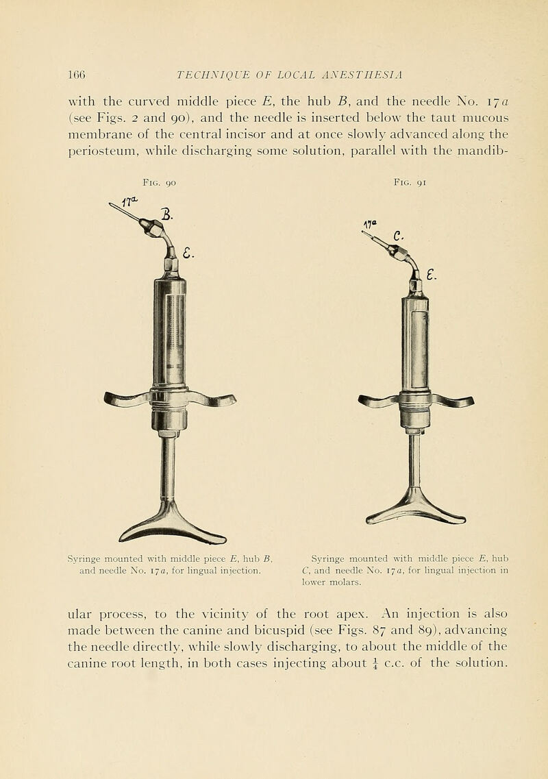 with the curved middle piece E, the hub B, and the needle Xo. 17a (see Figs. 2 and 90), and the needle is inserted below the taut mucous membrane of the central incisor and at once slowly advanced along the periosteum, while discharging some solution, parallel with the mandib- FiG. 90 Fig. 91 Syringe mounted with middle piece E, luib B. and needle No. 17a, for lingual injection. Syringe mounted with middle piece E. hub C, and needle No. 17c, for lingual injection in lower molars. ular process, to the vicinity- of the root apex. An injection is also made between the canine and bicuspid (see Figs. 87 and 89), advancing the needle directly, while slowly discharging, to about the middle of the canine root length, in both cases injecting about | c.c. of the solution.