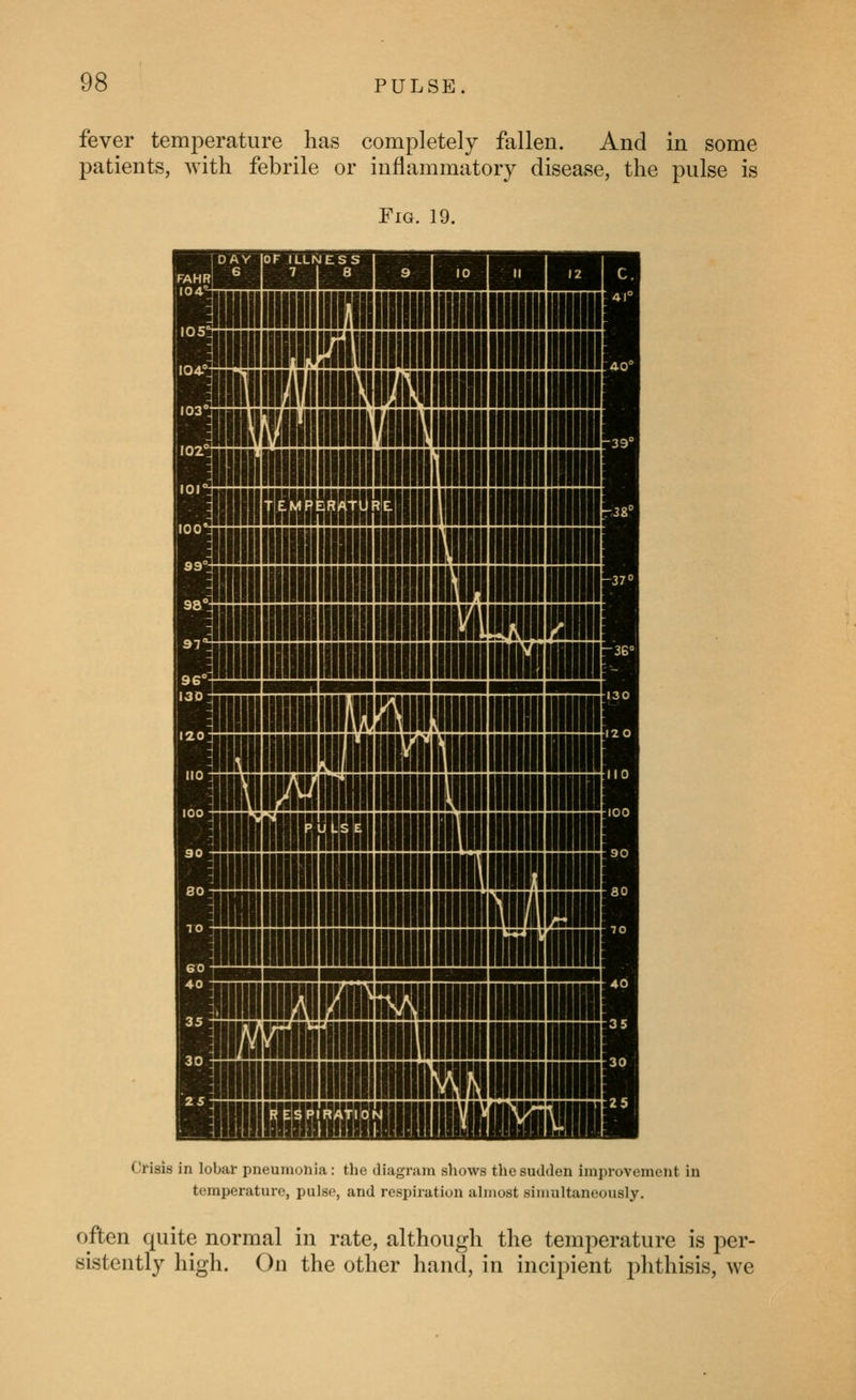 fever temj^erature has completely fallen. And in some patients, Avith febrile or inflammatory disease, the pulse is Fig. 19. Crisis in lobar pneumonia: tlie diagram shows the sudden improvement in temperature, pulse, and respiiation ahiiost simultaneously. often quite normal in rate, although the temperature is per- sistently high. On the other hand, in incipient phthisis, we