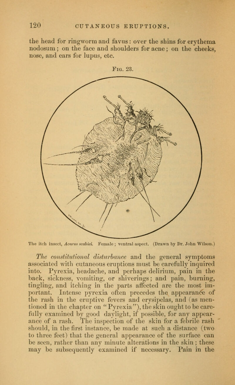 the head for ringworm and faviis : over the shins for erythema nodosum ; on the face and shoulders for acne; on the cheeks, nose, and ears for lupus, etc. Fig. 23. The itch insect, Acarus scabiei. Female ; ventral aspect. (Drawn by Pr. John Wilson.) The constitutional disturbance and the general symptoms associated with cutaneous eruptions must be carefully inquired into. Pyrexia, headache, and perhaps delirium, pain in the back, sickness, vomiting, or shiverings; and pain, burning, tingling, and itching in the parts affected are the most im- portant. Intense pyrexia often precedes the appearan<5e of the rash in the eruptive fevers and erysipelas, and (as men- tioned in the chapter on Pyrexia), the skin ought to be care- fully examined by good daylight, if possible, for any appear- ance of a rash. The inspection of the skin for a febrile rash should, in the first instance, be made at such a distance (two to three feet) that the general appearance of the surface can be seen, rather tlian any minute alterations in the skin ; these may be subsequently examined if necessary. Pain in the