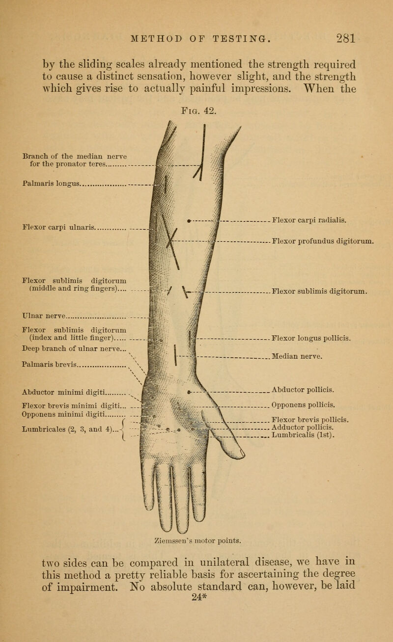 by the sliding scales already mentioned the strength required to cause a distinct sensation, however slight, and the strength which gives rise to actually painful impressions. When the Abductor minimi digiti, Flexor brevis minimi digiti... Opponens minimi digiti , Lumbricales (2, 3, and 4).. Fig. 42. Branch of the median nerve for the pronator teres Palmaris longus Flexor carpi ulnaris Flexor sublimis digitorum (middle and ring fingers).... Ulnar nerve Flexor sublimis digitorum (index and little finger Deep branch of ulnar nerve... Palmaris brevis Flexor carpi radialis. Flexor profundus digitorum. -Flexor sublimis digitorum. . Flexor longi;s pollicis. . Median nerve. ^^ »---^^ Abductor pollicis. , Opponens pollicis. ^^^^i--..^- Flexor brevis pollicis. -«■ 4 ^^^^^^fr—-^— Adductor pollicis. 7^^H^ft*—\ -.- Lumbricalis (1st). Ziemssen's motor points. two sides can be compared in unilateral disease, we have in this method a pretty reliable basis for ascertaining the degree of impairment. No absolute standard can, however, be laid 24*