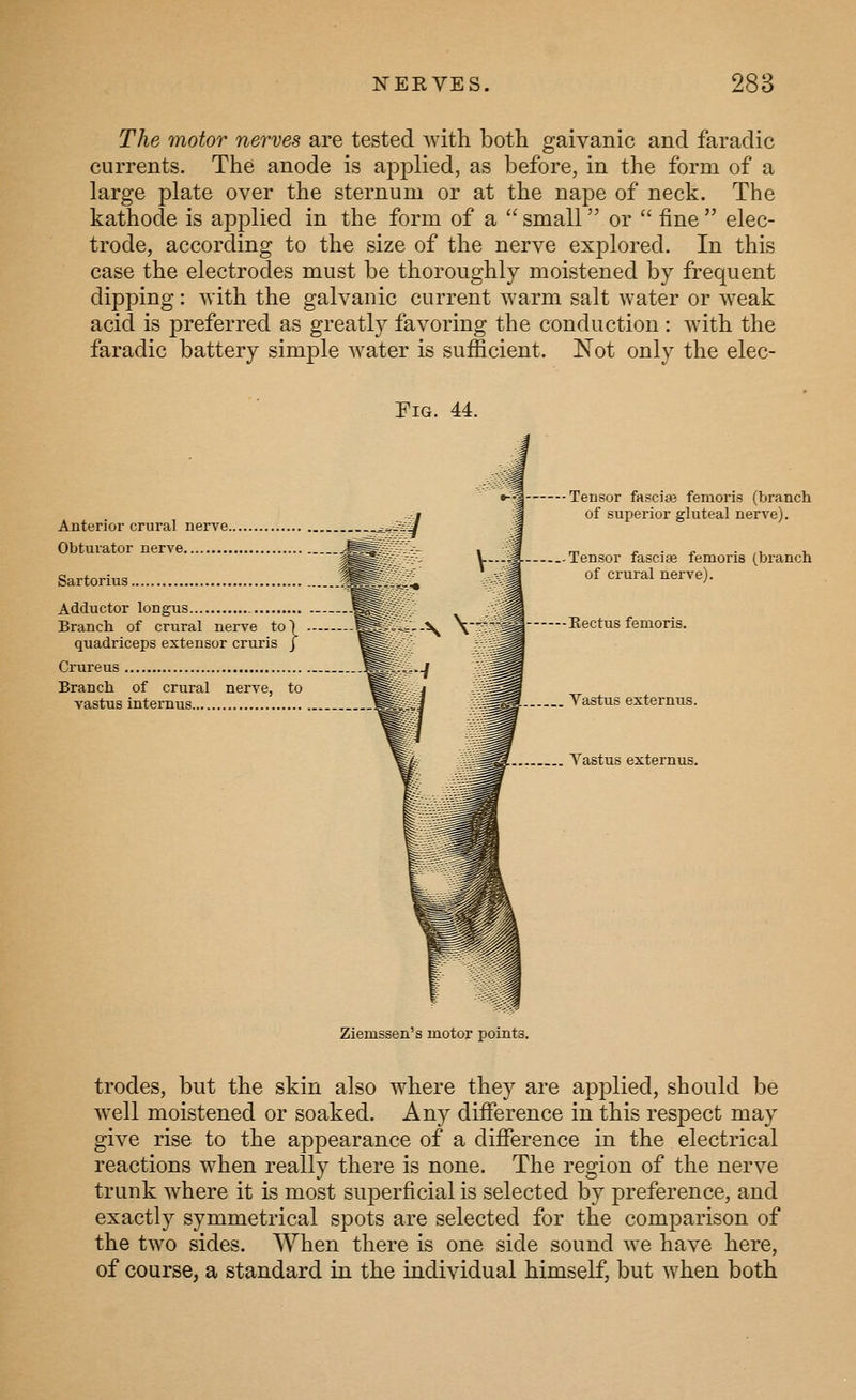 The motor nerves are tested with both galvanic and faradic currents. The anode is applied, as before, in the form of a large plate over the sternum or at the nape of neck. The kathode is applied in the form of a  small or  fine  elec- trode, according to the size of the nerve explored. In this case the electrodes must be thoroughly moistened by frequent dipping: with the galvanic current warm salt water or weak acid is preferred as greatly favoring the conduction : Avith the faradic battery simple water is sufficient. Not only the elec- FiG. 44. Anterior crural nerve.. Obturator nerve Sartorius Adductor longus Branch of crural nerve to quadriceps extensor cruris Grureus Branch of crural vastus internus Tensor fafsciaa femoris (branch of superior gluteal nerve). Tensor fasciae femoris (branch of crural nerve). -Kectus femoris. Vastus externus. Vastus externus. Ziemssen's motor points. trodes, but the skin also where they are applied, should be well moistened or soaked. Any difference in this respect may give rise to the appearance of a difference in the electrical reactions when really there is none. The region of the nerve trunk where it is most superficial is selected by preference, and exactly symmetrical spots are selected for the comparison of the two sides. When there is one side sound we have here, of course, a standard in the individual himself, but when both