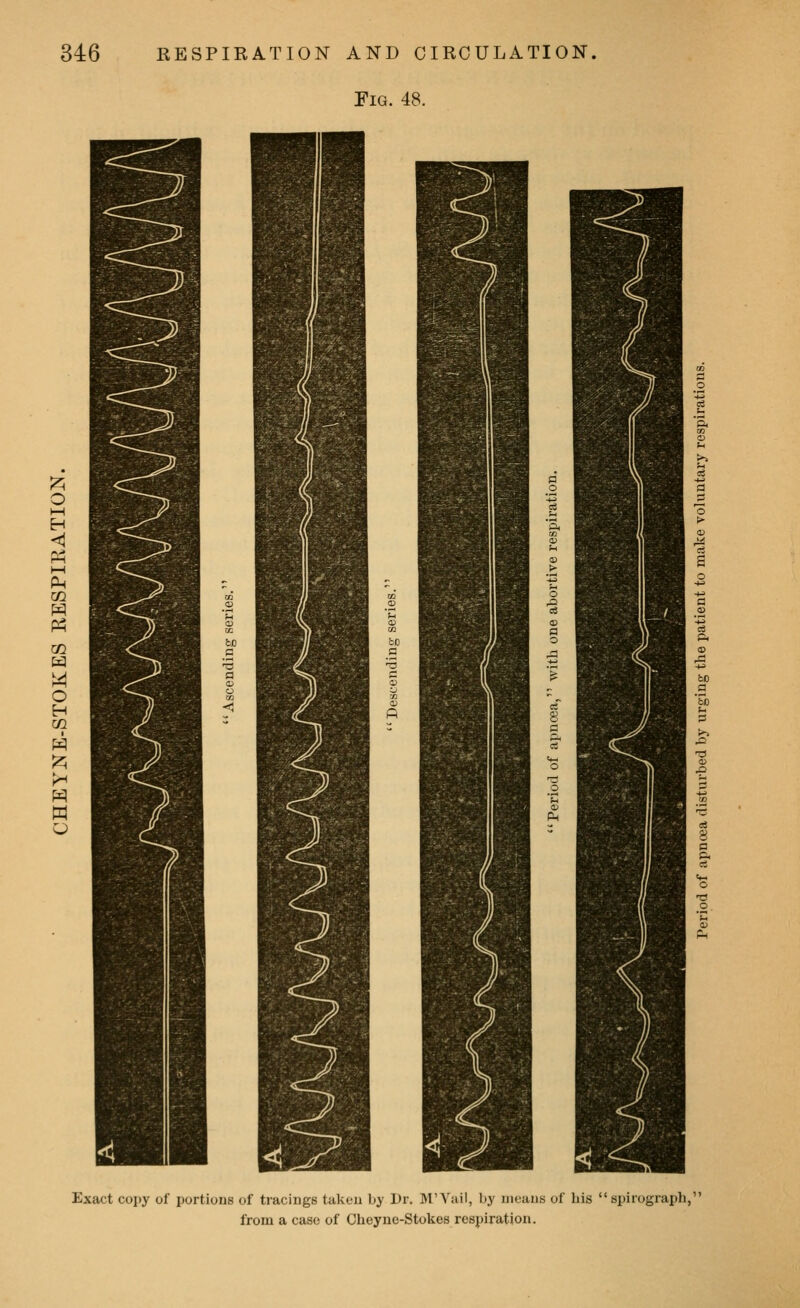 Pl«. 48. 1 I o I—I H <I m m i-H o H m w 1 i Exact cojjy of portions of tracings taken by Dr. M'Yail, by means of his spirograph, from a case of Cheyne-Stokes respiration.