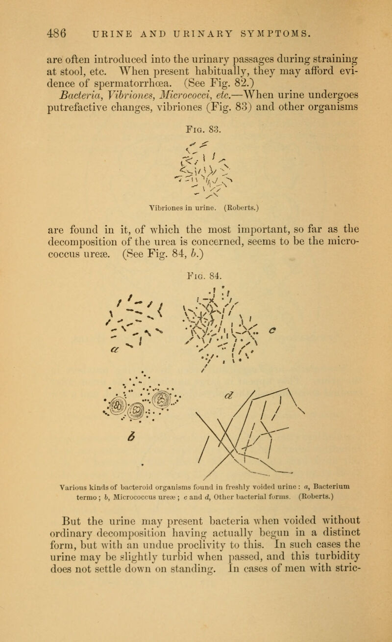 are often introduced into the urinary passages during straining at stool, etc. When present habitually, they may afford evi- dence of spermatorrhoea. (See Fig. 82.) Bacteria, Vibrlones, Micrococci, etc.—When urine undergoes putrefactive changes, vibriones (Fig. 83) and other organisms Tig. 83. Vibriones in urine. (Roberts.) are found in it, of which the most important, so far as the decomposition of the urea is concerned, seems to be the micro- coccus urese. (See Fig. 84, 5.) Fig. 84. ^ Iff / I I • Various kinds of bacteroid organisms found in freshly voided urine : a, Bacterium termo ; 6, Micrococcus ureiii; c and d, Other bacterial forms. (Roberts.) But the urine may present bacteria when voided without ordinary decomposition having actually begun in a distinct form, but with an undue proclivity to this. In such cases the urine may be slightly turbid when passed, and this turbidity does not settle down on standing. In cases of men with stric-