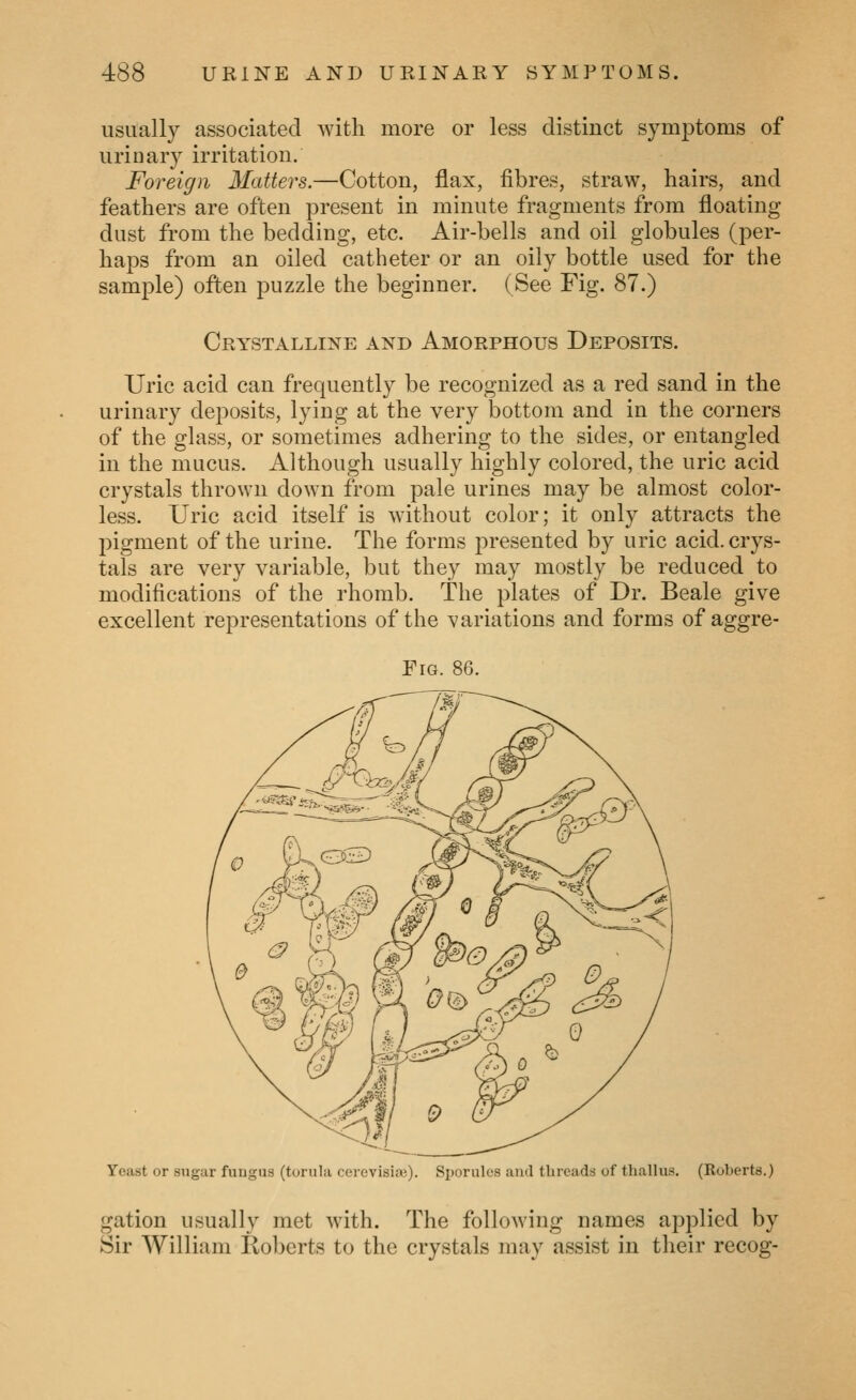 usually associated with more or less distinct symptoms of urinary irritation. Foreign Matters.—Cotton, flax, fibres, straw, hairs, and feathers are often present in minute fragments from floating dust from the bedding, etc. Air-bells and oil globules (per- haps from an oiled catheter or an oily bottle used for the sample) often puzzle the beginner. (See Fig. 87.) Crystalline and Amorphous Deposits. Uric acid can frequently be recognized as a red sand in the urinary deposits, lying at the very bottom and in the corners of the glass, or sometimes adhering to the sides, or entangled in the mucus. Although usually highly colored, the uric acid crystals thrown down from pale urines may be almost color- less. Uric acid itself is without color; it only attracts the pigment of the urine. The forms presented by uric acid, crys- tals are very variable, but they may mostly be reduced to modifications of the rhomb. The plates of Dr. Beale give excellent representations of the variations and forms of aggre- FiG. 86. Yeast or sugar fungus (toriila cerevisiaj). Sporules and threads of thallus, (Roberts.) gation usually met with. The following names applied by Sir William Roberts to the crystals may assist in their recog-