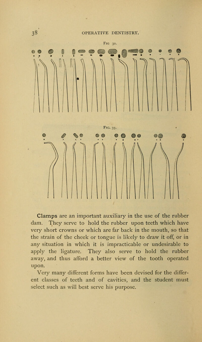 Fig 32. Frc. 33. Clamps are an important auxiliary in the use of the rubber dam. They serve to hold the rubber upon teeth which have very short crowns or which are far back in the mouth, so that the strain of the cheek or tongue is likely to draw it off, or in any situation in which it is impracticable or undesirable to apply the ligature. They also serve to hold the rubber away, and thus afford a better view of the tooth operated upon. Very many different forms have been devised for the differ- ent classes of teeth and of cavities, and the student must select such as will best serve his purpose.