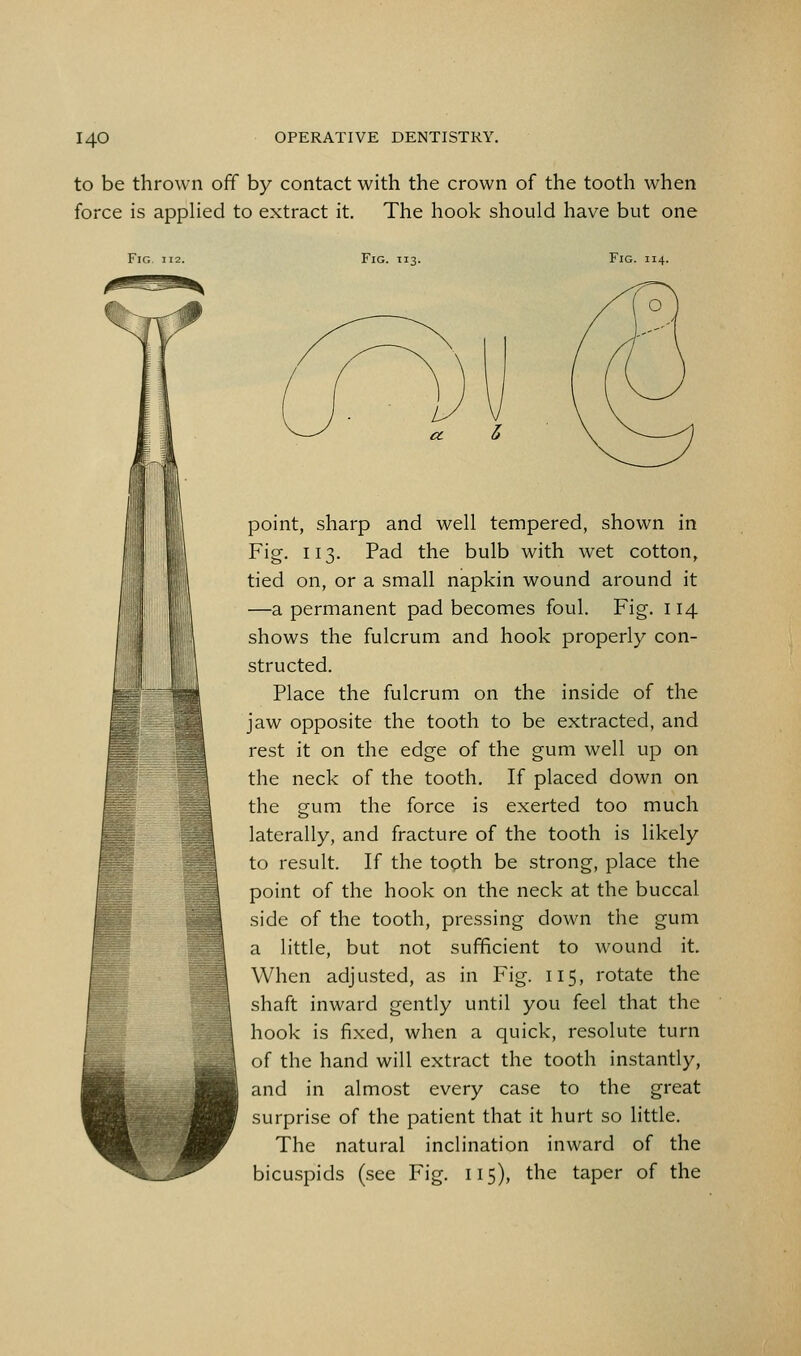 to be thrown off by contact with the crown of the tooth when force is appHed to extract it. The hook should have but one Fig 112. Fig. T13. Fig. 114. point, sharp and well tempered, shown in Fig. 113. Pad the bulb with wet cotton, tied on, or a small napkin wound around it —a permanent pad becomes foul. Fig. 114 shows the fulcrum and hook properly con- structed. Place the fulcrum on the inside of the jaw opposite the tooth to be extracted, and rest it on the edge of the gum well up on the neck of the tooth. If placed down on the gum the force is exerted too much laterally, and fracture of the tooth is likely to result. If the topth be strong, place the point of the hook on the neck at the buccal side of the tooth, pressing down the gum a little, but not sufficient to wound it. When adjusted, as in Fig. 115, rotate the shaft inward gently until you feel that the hook is fixed, when a quick, resolute turn of the hand will extract the tooth instantly, and in almost every case to the great surprise of the patient that it hurt so little. The natural inclination inward of the bicuspids (see Fig. 115), the taper of the