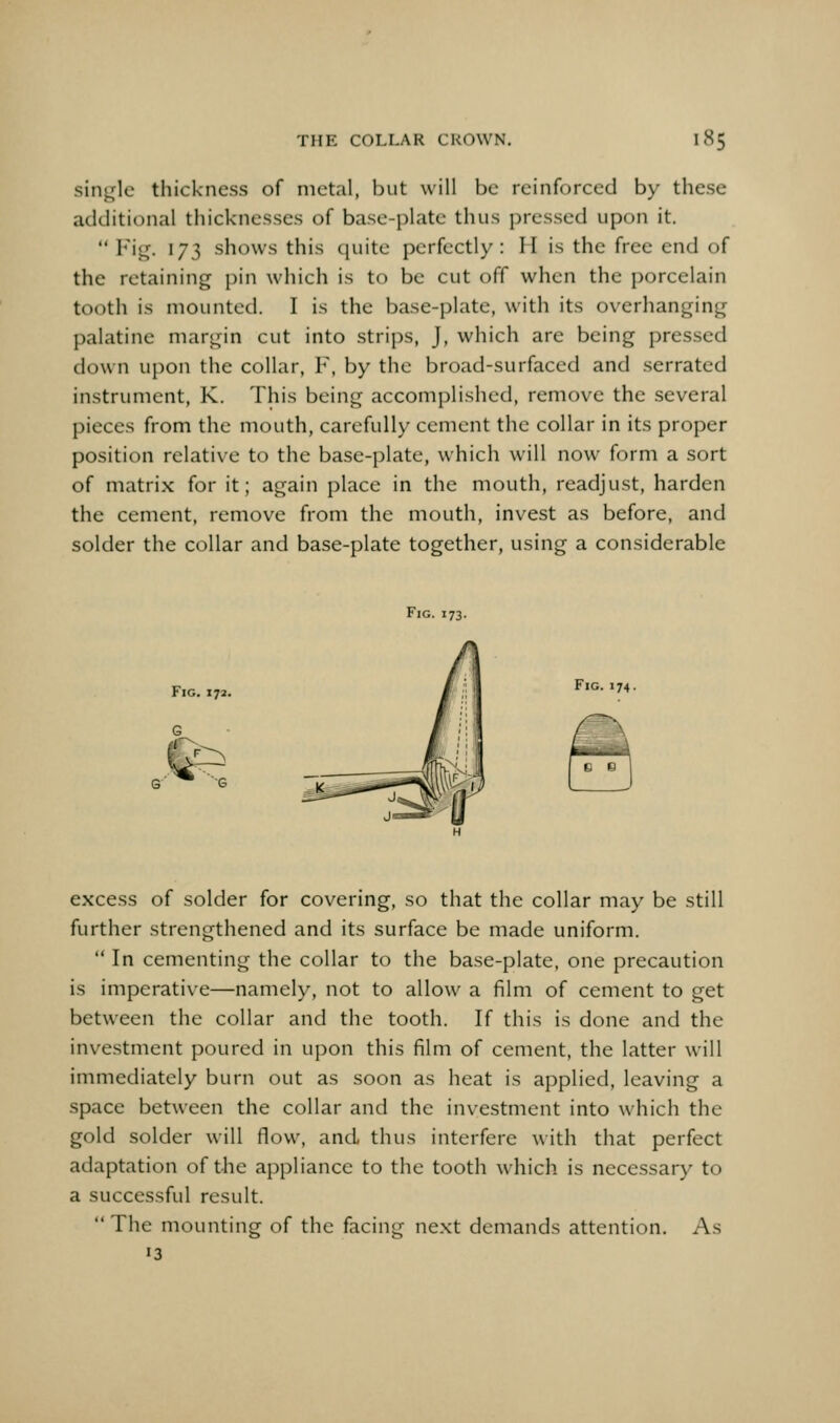 single thickness of metal, but will be reinforced by these additional thicknesses of base-plate thus pressed upon it.  Fi^. 173 shows this cjuite perfectly: H is the free end of the retaining pin which is to be cut off when the porcelain tooth is mounted. I is the base-plate, with its overhanging palatine margin cut into strips, J, which are being pressed down upon the collar, F, by the broad-surfaced and serrated instrument, K. This being accomplished, remove the several pieces from the mouth, carefully cement the collar in its proper position relative to the base-plate, which will now form a sort of matrix for it; again place in the mouth, readjust, harden the cement, remove from the mouth, invest as before, and solder the collar and base-plate together, using a considerable Fig. 173. Fig. 172. Fig. J74. excess of solder for covering, so that the collar may be still further strengthened and its surface be made uniform.  In cementing the collar to the base-plate, one precaution is imperative—namely, not to allow a film of cement to get between the collar and the tooth. If this is done and the investment poured in upon this film of cement, the latter will immediately burn out as soon as heat is applied, leaving a space between the collar and the investment into which the gold solder will flow, and thus interfere with that perfect adaptation of the appliance to the tooth which is necessar)' to a successful result.  The mounting of the facing next demands attention. As 13