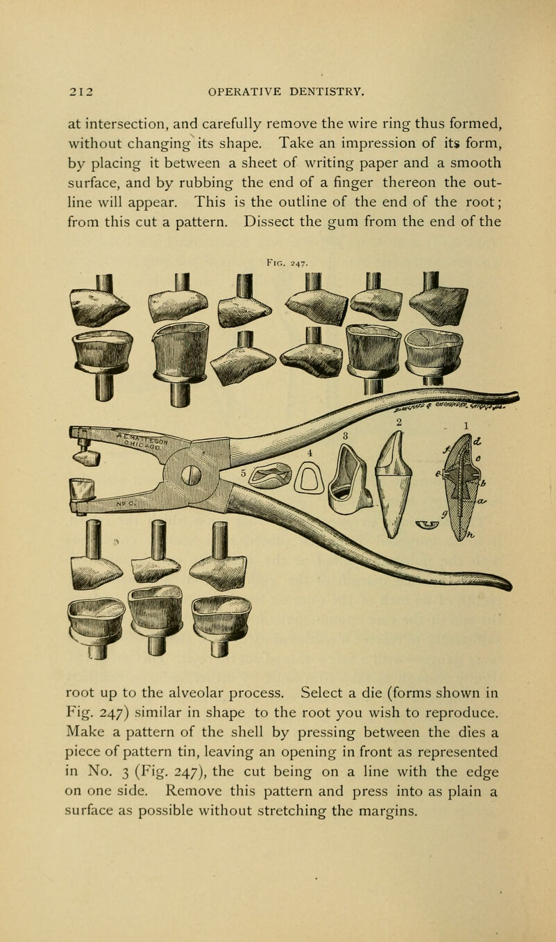 at intersection, and carefully remove the wire ring thus formed, without changing its shape. Take an impression of its form, by placing it between a sheet of writing paper and a smooth surface, and by rubbing the end of a finger thereon the out- line will appear. This is the outline of the end of the root; from this cut a pattern. Dissect the gum from the end of the Fig. 247. root up to the alveolar process. Select a die (forms shown in Fig. 247) similar in shape to the root you wish to reproduce. Make a pattern of the shell by pressing between the dies a piece of pattern tin, leaving an opening in front as represented in No. 3 (Fig. 247), the cut being on a line with the edge on one side. Remove this pattern and press into as plain a surface as possible without .stretching the margins.