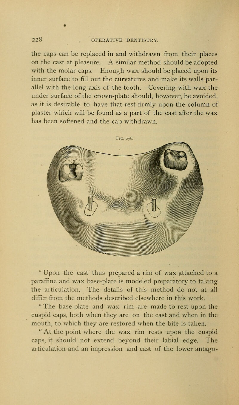 the caps can be replaced in and withdrawn from their places on the cast at pleasure. A similar method should be adopted with the molar caps. Enough wax should be placed upon its inner surface to fill out the curvatures and make its walls par- allel with the long axis of the tooth. Covering with wax the under surface of the crown-plate should, however, be avoided, as it is desirable to have that rest firmly upon the column of plaster which will be found as a part of the cast after the wax has been softened and the cap withdrawn. Fig. 276.  Upon the cast thus prepared a rim of wax attached to a paraffine and wax base-plate is modeled preparatory to taking the articulation. The details of this method do not at all differ from the methods described elsewhere in this work. The base-plate and wax rim are made to rest upon the cuspid caps, both when they are on the cast and when in the mouth, to which they are restored when the bite is taken.  At the point where the wax rim rests upon the cuspid caps, it should not extend beyond their labial edge. The articulation and an impression and cast of the lower antago-