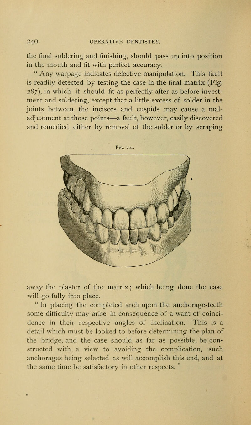 the final soldering and finishing, should pass up into position in the mouth and fit with perfect accuracy.  Any warpage indicates defective manipulation. This fault is readily detected by testing the case in the final matrix (Fig. 287), in which it should fit as perfectly after as before invest- ment and soldering, except that a little excess of solder in the joints between the incisors and cuspids may cause a mal- adjustment at those points—a fault, however, easily discovered and remedied, either by removal of the solder or by scraping Fig. 2QI. away the plaster of the matrix; which being done the case will go fully into place.  In placing the completed arch upon the anchorage-teeth some difficulty may arise in consequence of a want of coinci- dence in their respective angles of inclination. This is a detail which must be looked to before determining the plan of the bridge, and the case should, as far as possible, be con- structed with a view to avoiding the complication, such anchorages being selected as will accomplish this end, and at the same time be satisfactory in other respects.