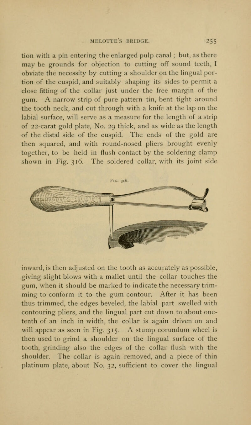 tion with a pin entering the enlarged pulp canal ; but, as there may be grounds for objection to cutting off sound teeth, I obviate the necessity by cutting a shoulder on the lingual por- tion of the cuspid, and suitably shaping its sides to permit a close fitting of the collar just under the free margin of the gum. A narrow strip of pure pattern tin, bent tight around the tooth neck, and cut through with a knife at the lap on the labial surface, will serve as a measure for the length of a strip of 22-carat gold plate, No. 29 thick, and as wide as the length of the distal side of the cuspid. The ends of the gold are then squared, and with round-nosed pliers brought evenly together, to be held in flush contact by the soldering clamp shown in Fig. 316. The soldered collar, with its joint side Vie. 316. inward, is then adjusted on the tooth as accurately as possible, giving slight blows with a mallet until the collar touches the gum, when it should be marked to indicate the necessary trim- ming to conform it to the gum contour. After it has been thus trimmed, the edges beveled, the labial part swelled with contouring pliers, and the lingual part cut down to about one- tenth of an inch in width, the collar is again driven on and will appear as seen in Fig. 315. A stump corundum wheel is then used to grind a shoulder on the lingual surface of the tooth, grinding also the edges of the collar flush with the shoulder. The collar is again removed, and a piece of thin platinum plate, about No. 32, sufficient to cover the lingual