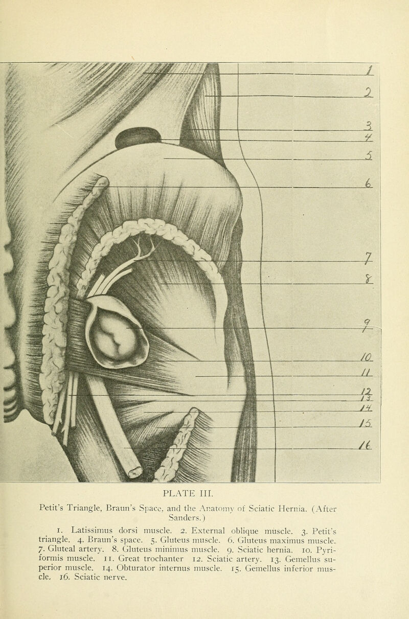 Petit's Triangle, Braun's Space, and the Anatomy of Sciatic Hernia. (After Sanders.) I. Latissimus dorsi muscle. 2. External oblique muscle. 3. Petit's triangle. 4. Braun's space. 5. Gluteus muscle. 6. Gluteus maximus muscle. 7. Gluteal artery. 8. Gluteus minimus muscle. 9. Sciatic hernia. 10. Pyri- formis muscle. 11. Great trochanter 12. Sciatic artery. 13. Gemellus su- perior muscle. 14. Obturator internus muscle. 15. Gemellus inferior mus- cle, 16, Sciatic nerve.