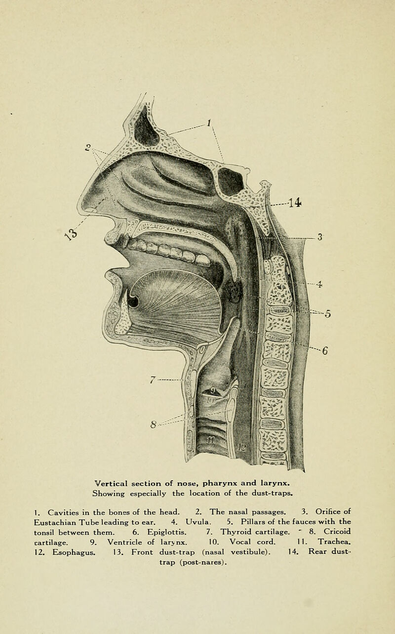 Vertical section of nose, pharynx and larynx. Showing especially the location of the dust-traps. I. Cavities in the bones of the head. 2. The nasal passages. 3. Orifice of Eustachian Tube leading to ear. 4. Uvula. 5. Pillars of the fauces with the tonsil between them. 6. Epiglottis. 7. Thyroid cartilage. ' 8. Cricoid cartilage. 9. Ventricle of larynx. 10. Vocal cord. 11. Trachea. 12. ELsophagus. 13. Front dust-trap (nasal vestibule). 14. Rear dust- trap (post-nares).