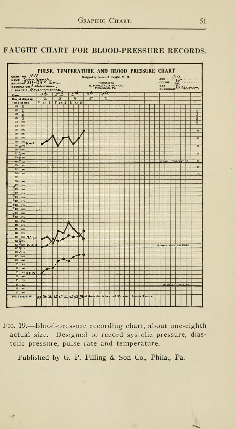 FAUGHT CHART I OR BLOOD-PRESSURE RECORDS. PULSE. TEMPERATURE AND BLOOD PRESSURE CHART COLOR ^ oo:o's°'*Jr ..CX>.V,v«.v^; —-^^^^-■^^ .r^ /^■^ -t^ >'* 3 4 s- t. » /I 6 «• /I t 8 11 , =»= IS - i =» s i P 215 108 270 107 265 106 ), f 255 I0< / V 3 \ l' u ^ 'Tc-r,« / \ / \/ 2,5.,02^' J9 235 2 100 2X>^ 99 _ _ __ 1 _ —1 — — n — - — - — - - — — - 215 96 205 200 200 ^190 ,90 ',85 ,85 S,75 ,75 a 170 ,70 §.60 ,60 1 i t 1^/ L '^' N I 't ° '» TJnr ^ \ ,/ ,^^ •^ L— * U ,25^,25 > r »•- : J N(R XAL B ao 1 PR SSU IE ,.5^„5 ■ ^ 105 ,05 P 100 ,00 »•■ S 1 95 95 1 90 90 , (-- 85 SSppp f 80 OO*  1 75 75 65 65 ■ rULSE PRESSURE H ^t jt w Vi3J ^i^:^^ H»' I J_ t In -J I ) Ct 1 2 Scnk Fig. 19.—Blood-pressure recording chart, about one-eighth actual size. Designed to record systolic pressure, dias- tolic pressure, pulse rate and temperature.