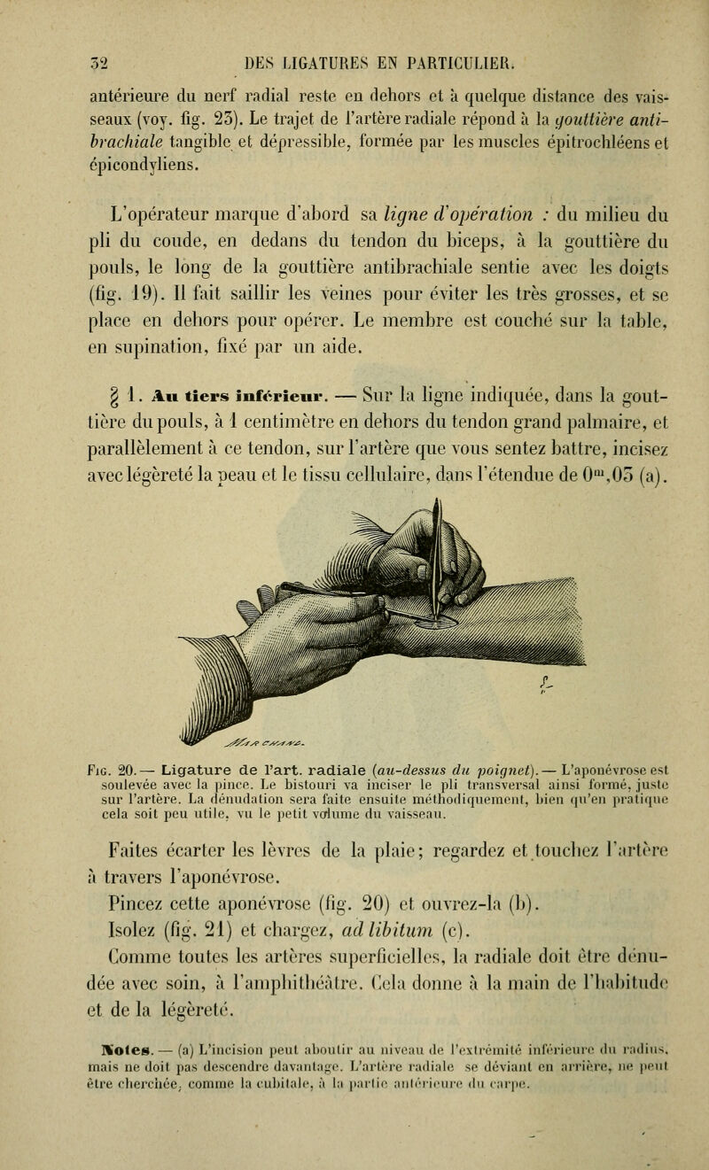 antérieure du nerf radial reste en dehors et à quelque distance des vais- seaux (voy. fig. 23). Le trajet de l'artère radiale répond à la gouttière anti- brachiale tangible et dépressible, formée par les muscles épitrochléens et épicondyliens. L'opérateur marque d'abord sa ligne d'opération : du milieu du pli du coude, en dedans du tendon du biceps, à la gouttière du pouls, le long de la gouttière antibrachiale sentie avec les doigts (fig. 19). Il fait saillir les veines pour éviter les très grosses, et se place en dehors pour opérer. Le membre est couché sur la table, en supination, fixé par un aide. § 1. Au tiers inférieur. — Sur la ligne indiquée, dans la gout- tière du pouls, à 1 centimètre en dehors du tendon grand palmaire, et parallèlement à ce tendon, sur l'artère que vous sentez battre, incisez avec légèreté la peau et le tissu cellulaire, dans l'étendue de 0m,05 (a). 5^/>f> dTAC^yfj: Fig. 20.— Ligature de l'art, radiale (au-dessus du poignet).— L'aponévrose est soulevée avec la pince. Le bistouri va inciser le pli transversal ainsi formé, juste sur l'artère. La dénudation sera faite ensuite méthodiquement, bien qu'en pratique cela soit peu utile, vu le petit volume du vaisseau. Faites écarter les lèvres de la plaie; regardez et touchez l'artère à travers l'aponévrose. Pincez cette aponévrose (fig. 20) et ouvrez-la (h). Isolez (fig. 21) et chargez, ad libitum (c). Comme toutes les artères superficielles, la radiale doit être dénu- dée avec soin, à l'amphithéâtre, delà donne à la main de l'habitude et de la légèreté. H'otes.— (a) L'incision peut aboutir au niveau de l'extrémité inférieure du radius, mais ne doit pas descendre davantage. L'artère radiale se déviant en arrière^ ne peu! être cherchée, comme la cubitale, à La partie antérieure du carpe.