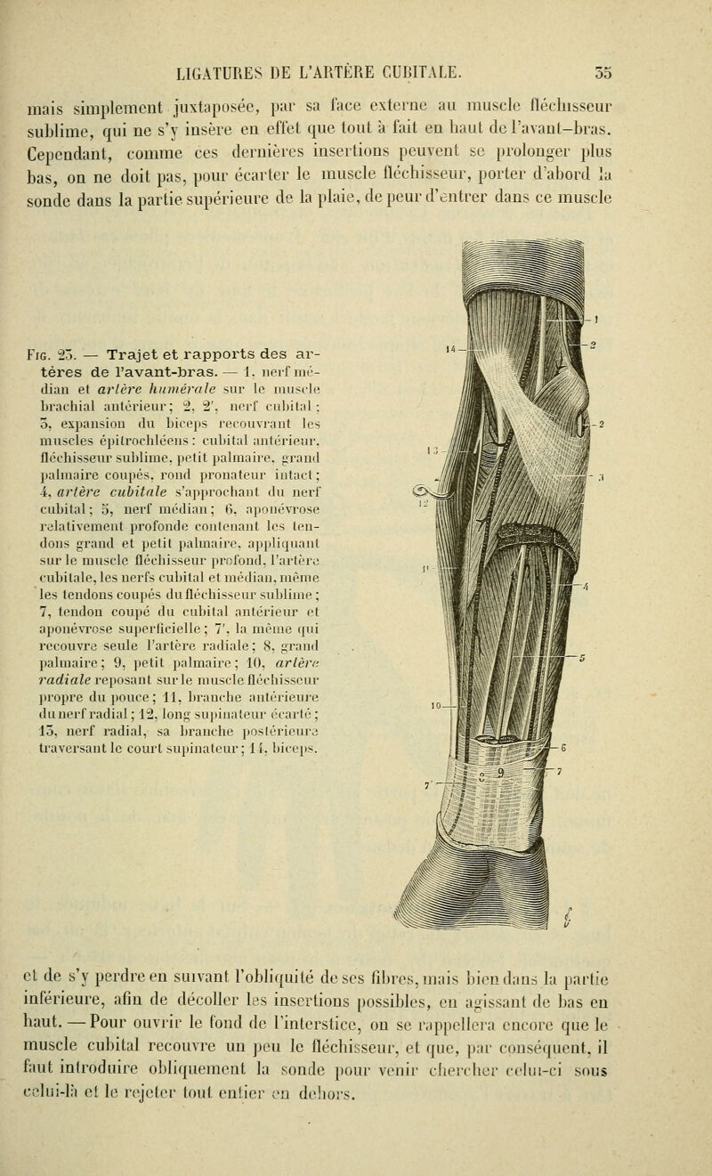 mais simplement juxtaposée, par sa face externe au muscle fléchisseur sublime, qui ne s'y insère en effet que tout à fait en haut del'avant-bras. Cependant, comme ces dernières insertions peuvent se prolonger plus bas, on ne doit pas, pour écarter le muscle fléchisseur, porter d'abord la sonde dans la partie supérieure de la plaie, de peur d'entrer dans ce muscle Fig. 23. — Trajet et rapports des ar- tères de l'avant-bras. — 1. nerf mé- dian et artère humérale sur le muscle brachial antérieur; 2, 2'. nerf cubital : 5, expansion du biceps recouvrant les muscles épilroehléens : cubital antérieur, fléchisseur sublime, petit palmaire, grand palmaire coupés, rond pronateur intact ; •4, artère cubitale s'approchant du nerf cubital; 5, nerf médian; 6, aponévrose relativement profonde contenant les ten- dons grand et petit palmaire, appliquant sur le muscle fléchisseur profond, l'artère cubitale, les nerfs cubital et médian, même les tendons coupés du fléchisseur sublime; 7, tendon coupé du cubital antérieur et aponévrose superficielle ; T. la môme qui recouvre seule l'artère radiale; 8, grand palmaire; 9, petit palmaire; 10, artère, radiale reposant sur le muscle fléchisseur propre du pouce; 11, branche antérieure du nerf radial ; 12, long supinateur écarté ; 15, nerf radial, sa branche postérieure traversant le court supinateur; 14, biceps. et de s'y perdre en suivant l'obliquité de ses fibres, mais bien dans la partie inférieure, afin de décoller les insertions possibles, en agissant de bas en haut. —Pour ouvrir le fond de l'interstice, on se rappellera encore que le muscle cubital recouvre un peu le fléchisseur, et que, par conséquent, il faut introduire obliquement la sonde pour venir chercher celui-ci sous celui-là et le rejeter tout entier en dehors.