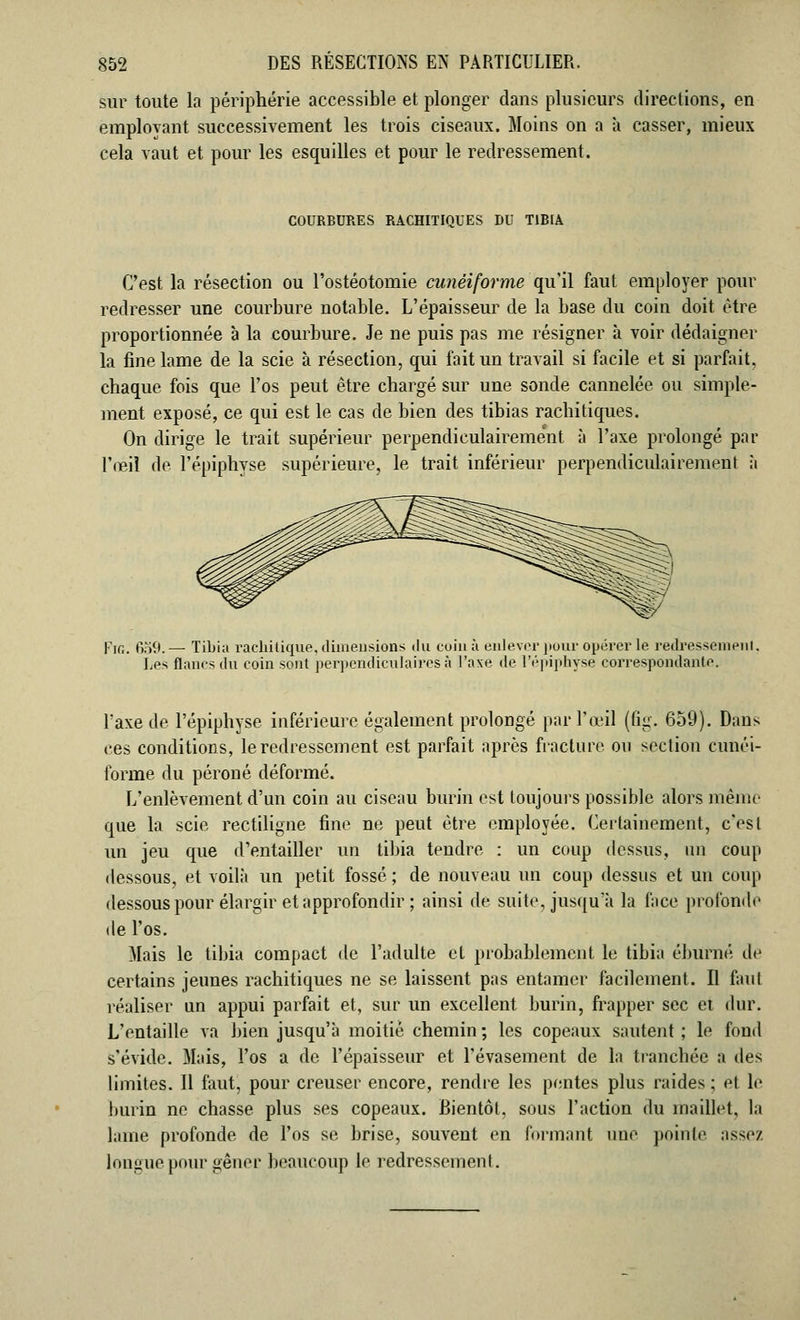 sur toute la périphérie accessible et plonger dans plusieurs directions, en employant successivement les trois ciseaux. Moins on a à casser, mieux cela vaut et pour les esquilles et pour le redressement. COURBURES RACHITIQUES DU TIBIA C'est la résection ou l'ostéotomie cunéiforme qu'il faut employer pour redresser une courbure notable. L'épaisseur de la base du coin doit être proportionnée à la courbure. Je ne puis pas me résigner à voir dédaigner la fine lame de la scie à résection, qui fait un travail si facile et si parfait, chaque fois que l'os peut être chargé sur une sonde cannelée ou simple- ment exposé, ce qui est le cas de bien des tibias rachitiques. On dirige le trait supérieur perpendiculairement à l'axe prolongé par l'œil de l'épiphvse supérieure, le trait inférieur perpendiculairement à Fie 659. — Tibia racliitique. dimensions du coin à enlever pour opérer le redressement. Les flancs du coin sont perpendiculaires à l'axe de l'épiphyse correspondante. Taxe de l'épiphyse inférieure également prolongé par l'œil (fig. 659). Dans ces conditions, le redressement est parfait après fracture ou section cunéi- forme du péroné déformé. L'enlèvement d'un coin au ciseau burin est toujours possible alors même que la scie rectiligne fine ne peut être employée. Certainement, c'est un jeu que d'entailler un tibia tendre : un coup dessus, un coup dessous, et voilà un petit fossé ; de nouveau un coup dessus et un coup dessous pour élargir et approfondir ; ainsi de suite, jusqu'à la face profonde de l'os. Mais le tibia compact de l'adulte et probablement le tibia éburné de certains jeunes rachitiques ne se laissent pas entamer facilement. Il faut réaliser un appui parfait et, sur un excellent, burin, frapper sec et dur. L'entaille va bien jusqu'à moitié chemin; les copeaux sautent; le fond s'évide. Mais, l'os a de l'épaisseur et l'évasement de la tranchée a des limites. Il faut, pour creuser encore, rendre les pentes plus raides ; et le burin ne chasse plus ses copeaux. Bientôt, sous l'action du maillet, la lame profonde de l'os se brise, souvent en formant une pointe assez longue pour gêner beaucoup le redressement.