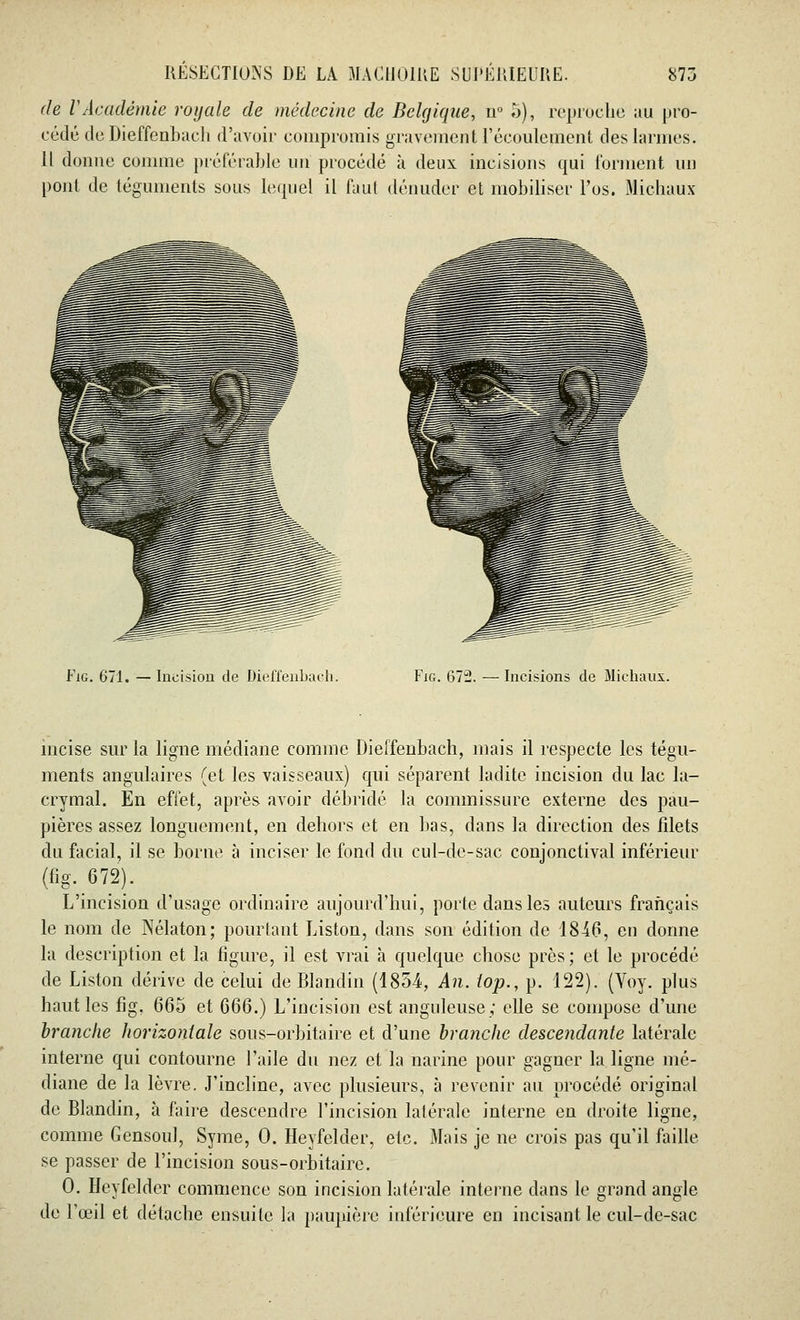 de VAcadémie royale de médecine de Belgique, n° 5), reproche au pro- cédé de Dieffenbach d'avoir compromis gravement l'écoulement des larmes. Il donne comme préférable un procédé à deux incisions qui forment un pont de téguments sous lequel il faut dénuder et mobiliser l'os. Michaux Fig. 671. — Incision de Dieffenbach. Fig. 67-. — Incisions de Michaux. meise sur la ligne médiane comme Dieffenbach, mais il respecte les tégu- ments angulaires (et les vaisseaux) qui séparent ladite incision du lac la- crymal. En effet, après avoir débridé la commissure externe des pau- pières assez longuement, en dehors et en bas, dans la direction des filets du facial, il se borne à inciser le fond du cul-de-sac conjonctival inférieur (fig. 672). L'incision d'usage ordinaire aujourd'hui, porte dans les auteurs français le nom de Nélaton; pourtant Liston, dans son édition de 18-10, en donne la description et la figure, il est vrai à quelque chose près; et le procédé de Liston dérive de celui de Blandin (1854, An. iop., p. 122). (Yoy. plus haut les fig. 665 et 666.) L'incision est anguleuse; elle se compose d'une branche horizontale sous-orbitaire et d'une branche descendante latérale interne qui contourne l'aile du nez et la narine pour gagner la ligne mé- diane de la lèvre. J'incline, avec plusieurs, à revenir au procédé original de Blandin, à faire descendre l'incision latérale interne en droite ligne, comme Gensoul, Syme, 0. Heyfelder, etc. Mais je ne crois pas qu'il faille se passer de l'incision sous-orbitaire. 0. Heyfelder commence son incision latérale interne dans le grand angle de l'œil et détache ensuite la paupière inférieure en incisant le cul-de-sac