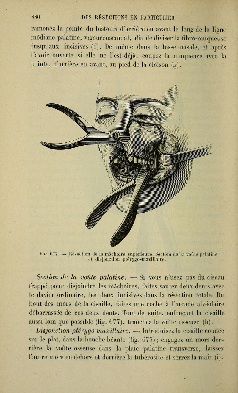 ramenez la pointe du bistouri d'arrière en ayant le long de la ligne médiane palatine, vigoureusement, afin de diviser la fibro-muqueuse jusqu'aux incisives (f). De même dans la fosse nasale, et après l'avoir ouverte si elle ne l'est déjà, coupez la muqueuse avec la pointe, d'arrière en avant, au pied de la cloison (g). Fut. 677. — Résection de la mâchoire supérieure. Section de la voûle palatine et disjonction ptérygo-maxillaire. Section de la voûte palatine. — Si vous n'usez pas du ciseau frappé pour disjoindre les mâchoires, faites sauter deux dents avec le davier ordinaire, les deux incisives dans la résection totale. Du bout des mors de la cisaille, faites une coche à l'arcade alvéolaire débarrassée de ces deux dents. Tout de suite, enfonçant la cisaille aussi loin que possible (fig. 677), tranchez la voûte osseuse (b). Disjonction ptérygo-maxillaire. — Introduisez la cisaille coudée sur le plat, dans la bouche béante (fig. 677) ; engagez un mors der- rière la voûte osseuse dans la plaie palatine transverse, laissez l'autre mors en dehors et derrière la tubérosilé cl serrez la main (i).