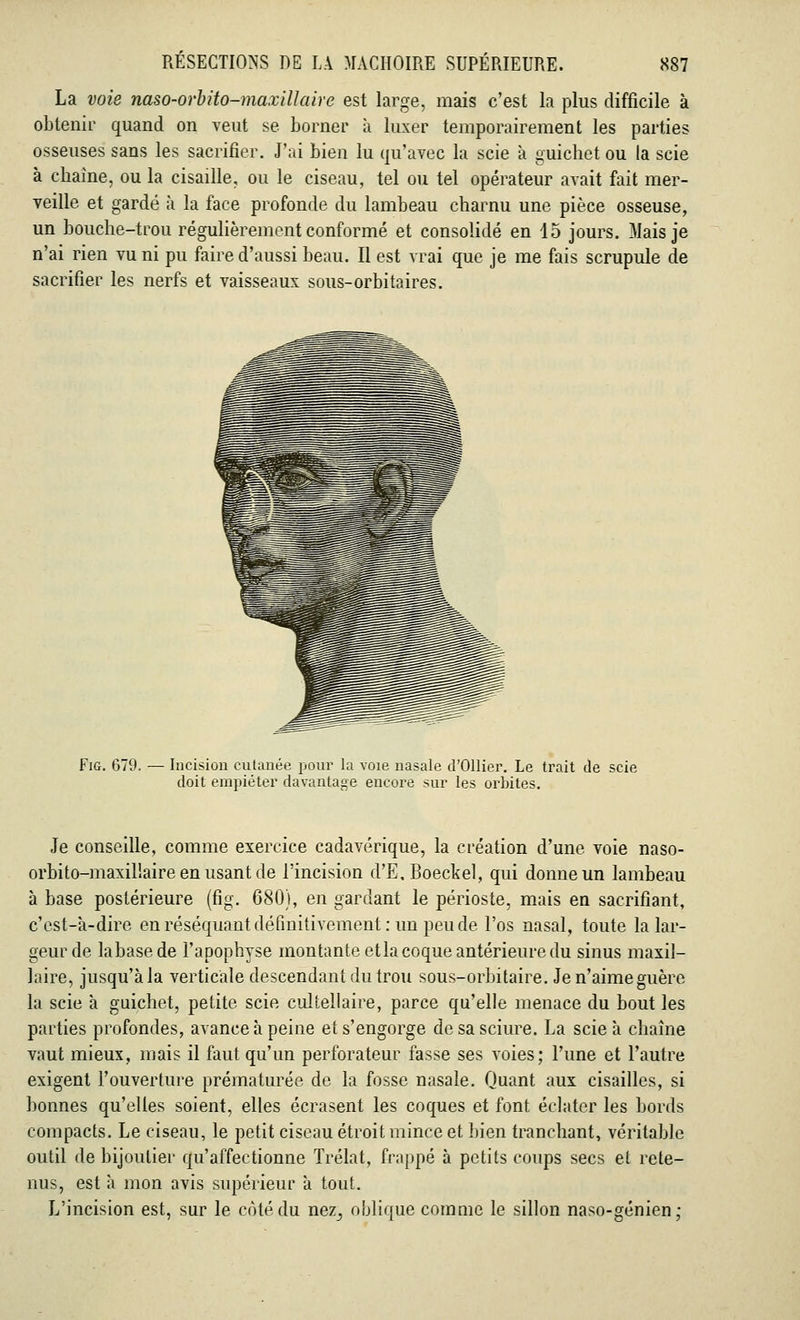 La voie naso-orbito-maxillaire est large, mais c'est la plus difficile à obtenir quand on veut se borner à luxer temporairement les parties osseuses sans les sacrifier. J'ai bien lu qu'avec la scie à guichet ou la scie à chaîne, ou la cisaille, ou le ciseau, tel ou tel opérateur avait fait mer- veille et gardé à la face profonde du lambeau charnu une pièce osseuse, un bouche-trou régulièrement conformé et consolidé en 15 jours. Mais je n'ai rien vu ni pu faire d'aussi beau. Il est vrai que je me fais scrupule de sacrifier les nerfs et vaisseaux sous-orbi ta ires. Fig. 679. — Incision cutanée pour la voie nasale d'Ollier. Le trait de scie doit empiéter davantage encore sur les orbites. Je conseille, comme exercice cadavérique, la création d'une voie naso- orbito-maxillaire en usant de l'incision d'E.Boeckel, qui donne un lambeau à base postérieure (fig. 680), en gardant le périoste, mais en sacrifiant, c'est-à-dire en réséquant définitivement : un peu de l'os nasal, toute la lar- geur de labasede l'apophyse montante etla coque antérieure du sinus maxil- laire, jusqu'à la verticale descendant du trou sous-orbitaire. Je n'aime guère la scie à guichet, petite scie cultellaire, parce qu'elle menace du bout les parties profondes, avance à peine et s'engorge de sa sciure. La scie à chaîne vaut mieux, mais il faut qu'un perforateur fasse ses voies; l'une et l'autre exigent l'ouverture prématurée de la fosse nasale. Quant aux cisailles, si bonnes qu'elles soient, elles écrasent les coques et font éclater les bords compacts. Le ciseau, le petit ciseau étroit mince et bien tranchant, véritable outil de bijoutier qu'affectionne Trélat, frappé à petits coups secs et rete- nus, est à mon avis supérieur à tout. L'incision est, sur le côté du nez^ oblique comme le sillon naso-génien;
