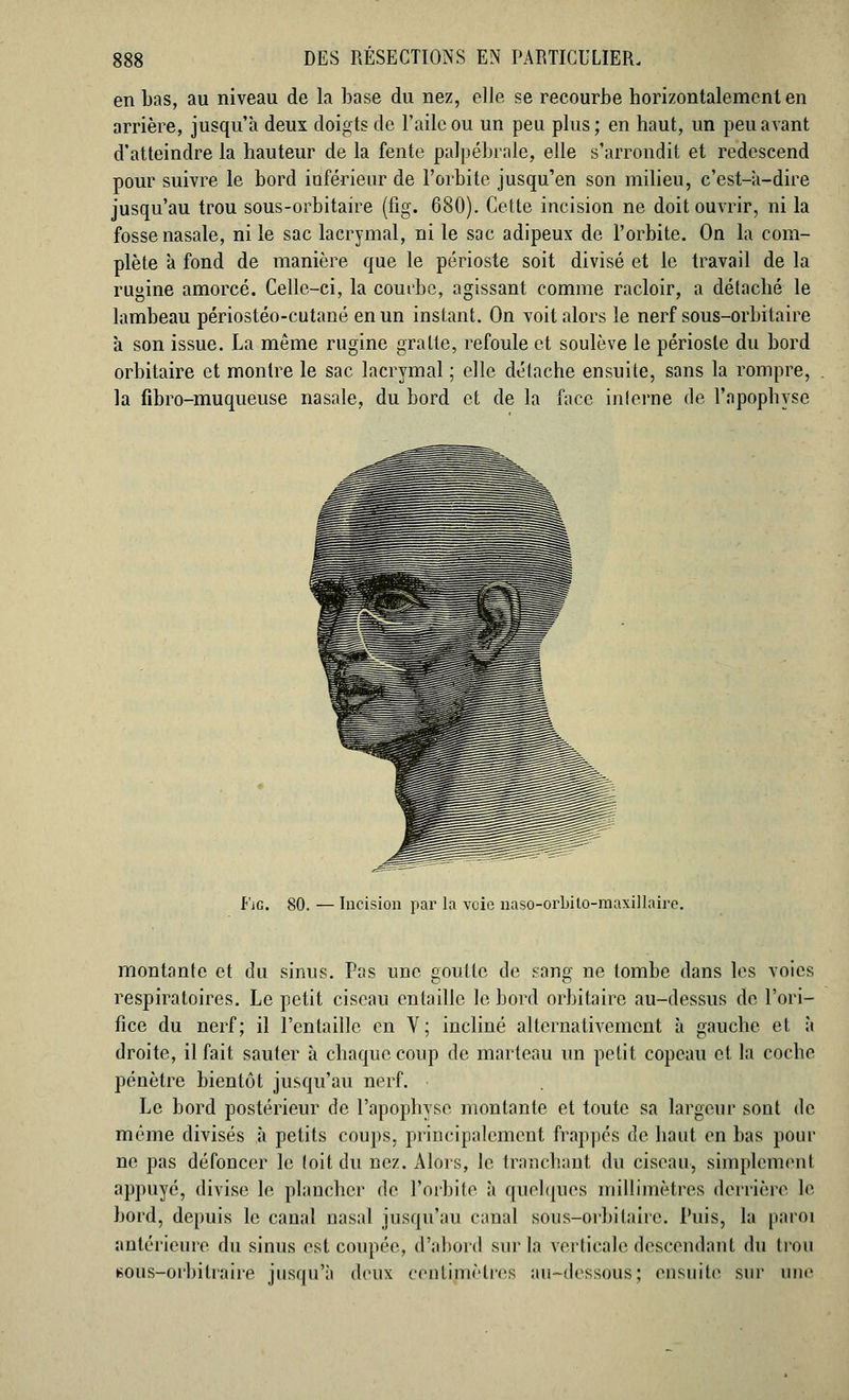 en Las, au niveau de la base du nez, elle se recourbe horizontalement en arrière, jusqu'à deux doigts de l'aile ou un peu plus; en haut, un peu avant d'atteindre la hauteur de la fente palpébrale, elle s'arrondit et redescend pour suivre le bord inférieur de l'orbite jusqu'en son milieu, c'est-à-dire jusqu'au trou sous-orbitaire (fig. 680). Cette incision ne doit ouvrir, ni la fosse nasale, ni le sac lacrymal, ni le sac adipeux de l'orbite. On la com- plète à fond de manière que le périoste soit divisé et le travail de la rugine amorcé. Celle-ci, la courbe, agissant comme racloir, a détaché le lambeau périostéo-cutané en un instant. On voit alors le nerf sous-orbitaire à son issue. La même rugine gratte, refoule et soulève le périoste du bord orbitaire et montre le sac lacrymal ; elle détache ensuite, sans la rompre, la fibro-muqueuse nasale, du bord et de la face interne de l'apophyse Fie. 80. — Incision par la voie naso-orbito-maxillaire. montante et du sinus. Pas une goutte de sang ne tombe dans les voies respiratoires. Le petit ciseau entaille le bord orbitaire au-dessus de l'ori- fice du nerf; il l'entaille en V; incliné alternativement à gauche et à droite, il fait sauter à chaque coup de marteau un petit copeau et la coche pénètre bientôt jusqu'au nerf. • Le bord postérieur de l'apophyse montante et toute sa largeur sont de même divisés à petits coups, principalement frappés de haut en bas pour ne pas défoncer le (oit du nez. Alors, le tranchant du ciseau, simplement appuyé, divise le plancher de l'orbite à quelques millimètres derrière le bord, depuis le canal nasal jusqu'au canal sous-orbitaire. Puis, la paroi antérieure du sinus est coupée, d'abord sur la verticale descendant du trou BOUS-orbitraire jusqu'à deux cèntijnètres au-dessous; ensuite sur une