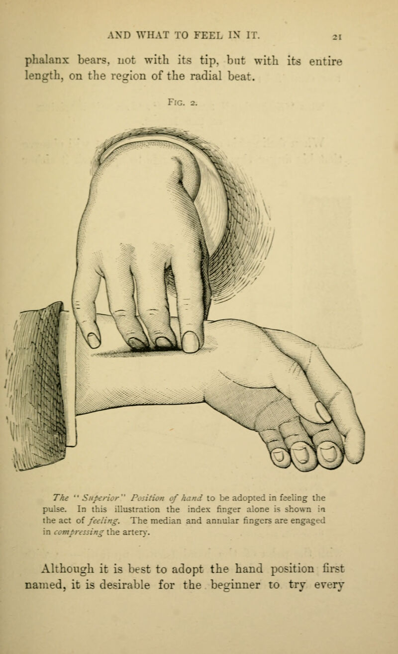 phalanx bears, not with its tip. but with its entire length, on the region of the radial beat. Fig. 2. The  Superi ition of hand to be adopted in feeling the pulse. In this illustration the index finger alone is show the act of feeling. The median and annular fingers are engaged in compressing the artery. Although it is best to adopt the hand position first named, it is desirable for the beginner to try every