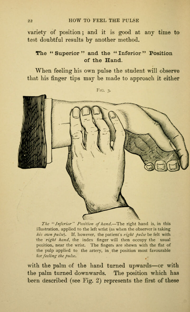 variety of position; and it is good at any time to test doubtful results by another method. The Superior and the Inferior Position of the Hand. When feeling his own pulse the student will observe that his finger tips may be made to approach it either Fig. 3. The Inferior Position of hand.—The right hand is, in this illustration, applied to the left wrist (as when the observer is taking his own pulse). If, however, the patient's right pulse be felt with the right hand, the index finger will then occupy the usual position, near the wrist. The fingers are shewn with the flat of the pulp applied to the artery, in the position most favourable for feeling the pulse. with the palm of the hand turned upwards—or with the palm turned downwards. The position which has been described (see Fig. 2) represents the first of these