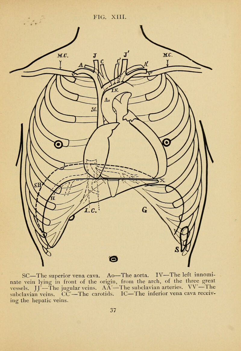 SC—The superior vena cava. Ao—The aorta. IV—The left innomi- nate vein lying in front of the origin, from the arch, of the three great 1_^ TT' The jugular veins. AA'—The subclavian arteries. W—The vessels. JJ subclavian veins. CC ing the hepatic veins. -The carotids. IC—The inferior vena cava receiv-