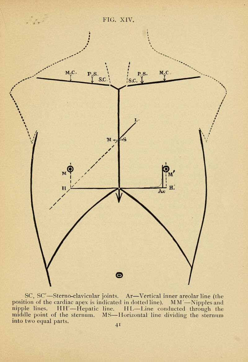 \ SC, SC—Sterno-clavicular joints. Ar—Vertical inner areolar line (the position of the cardiac apex is indicated in dotted line). MM'—Nipples and nipple lines, HH'—Hepatic line. HL—Line conducted through the middle point of the sternum. MS—Horizontal line dividing the sternum into two equal parts.