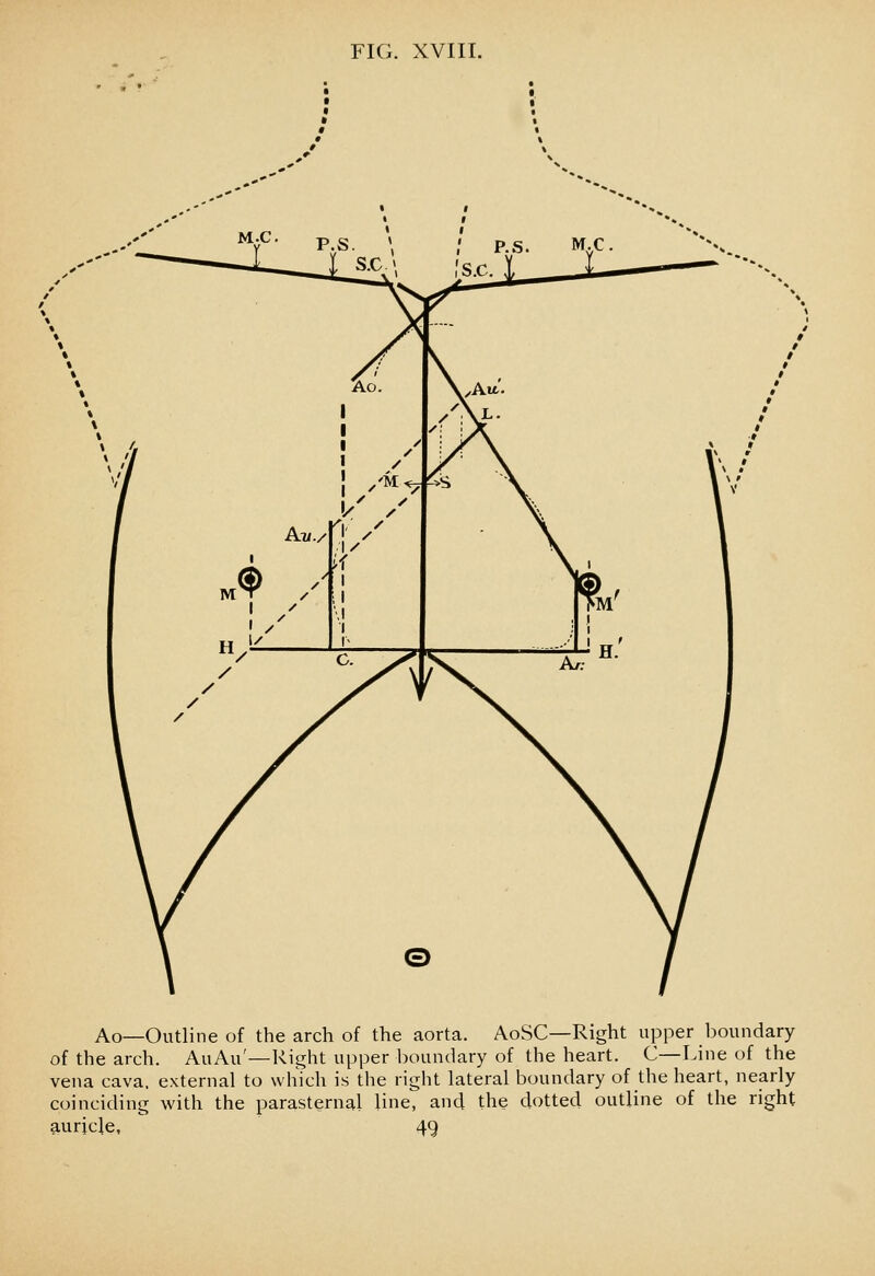 Ao—Outline of the arch of the aorta. AoSC—Right upper boundary of the arch. AuAu'—Right upper boundary of the heart. C—Line of the vena cava, external to which is the right lateral boundary of the heart, nearly coinciding with the parasternal line, and the dotted outline of the right