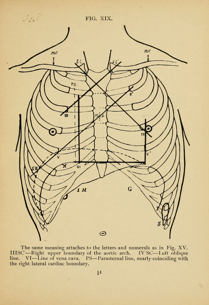 The same meaning attaches to the letters and numerals as in Fig, XV. IIISC—Right upper boundary of the aortic arch. IV'SC—Left oblique line. VI—Line of vena cava. PS—Parasternal line, nearly coinciding with the right lateral cardiac boundary.