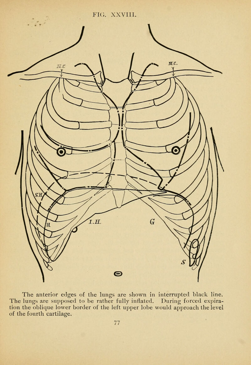 The anterior edges of the lungs are shown in interrupted black line. The lungs are supposed to be rather fully inflated. During forced expira- tion the oblique loM'er border of the left upper lobe would approach the level of the fourth cartilage.