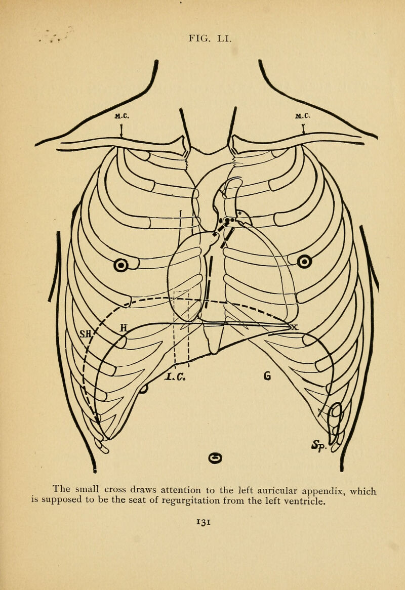 The small cross draws attention to the left auricular appendix, which is supposed to be the seat of regurgitation from the left ventricle.