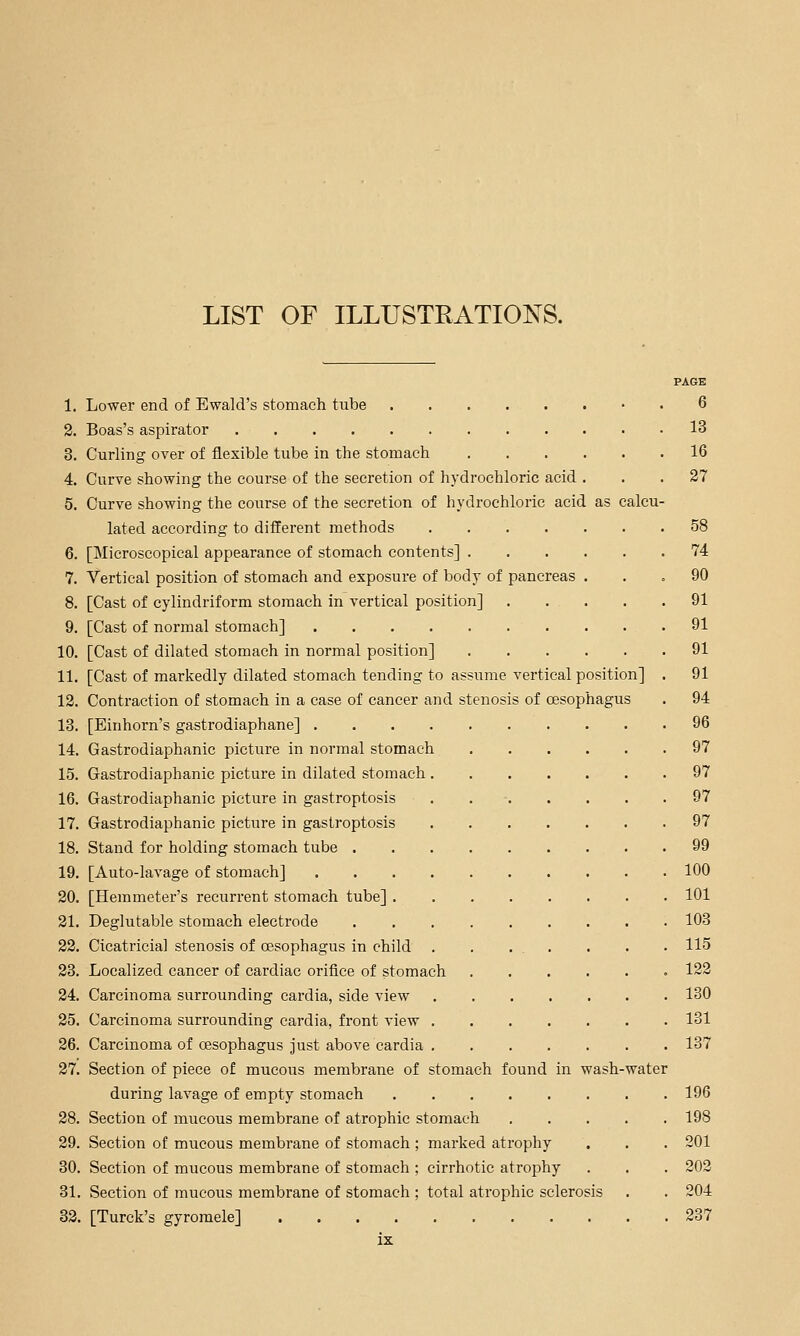 LIST OF ILLUSTRATIONS. PAGE 1. Lower end of Ewald's stomach tube 6 2. Boas's aspirator 13 3. Curling over of flexible tube in the stomach 16 4. Curve showing the course of the secretion of hydrochloric acid ... 27 5. Curve showing the course of the secretion of hydrochloric acid as calcu- lated according to different methods 58 6. [Microscopical appearance of stomach contents] 74 7. Vertical position of stomach and exposure of body of pancreas ... 90 8. [Cast of cylindriform stomach in vertical position] 91 9. [Cast of normal stomach] 91 10. [Cast of dilated stomach in normal position] 91 11. [Cast of markedly dilated stomach tending to assume vertical position] . 91 12. Contraction of stomach in a case of cancer and stenosis of oesophagus . 94 13. [Einhorn's gastrodiaphane] 96 14. Gastrodiaphanic picture in normal stomach 97 15. Gastrodiaphanic picture in dilated stomach 97 16. Gastrodiaphanic picture in gastroptosis . . ■ 97 17. Gastrodiaphanic picture in gastroptosis 97 18. Stand for holding stomach tube 99 19. [Auto-lavage of stomach] 100 20. [Hemmeter's recurrent stomach tube] 101 21. Deglutable stomach electrode 103 22. Cicatricial stenosis of oesophagus in child . . ... . . . 115 23. Localized cancer of cardiac orifice of stomach 122 24. Carcinoma surrounding cardia, side view 130 25. Carcinoma surrounding cardia, front view 131 26. Carcinoma of oesophagus just above cardia 137 27. Section of piece of mucous membrane of stomach found in wash-water during lavage of empty stomach 196 28. Section of mucous membrane of atrophic stomach 198 29. Section of mucous membrane of stomach ; marked atrophy . . . 201 30. Section of mucous membrane of stomach ; cirrhotic atrophy . . . 202 31. Section of mucous membrane of stomach ; total atrophic sclerosis . . 204 32. [Turck's gyromele] 237