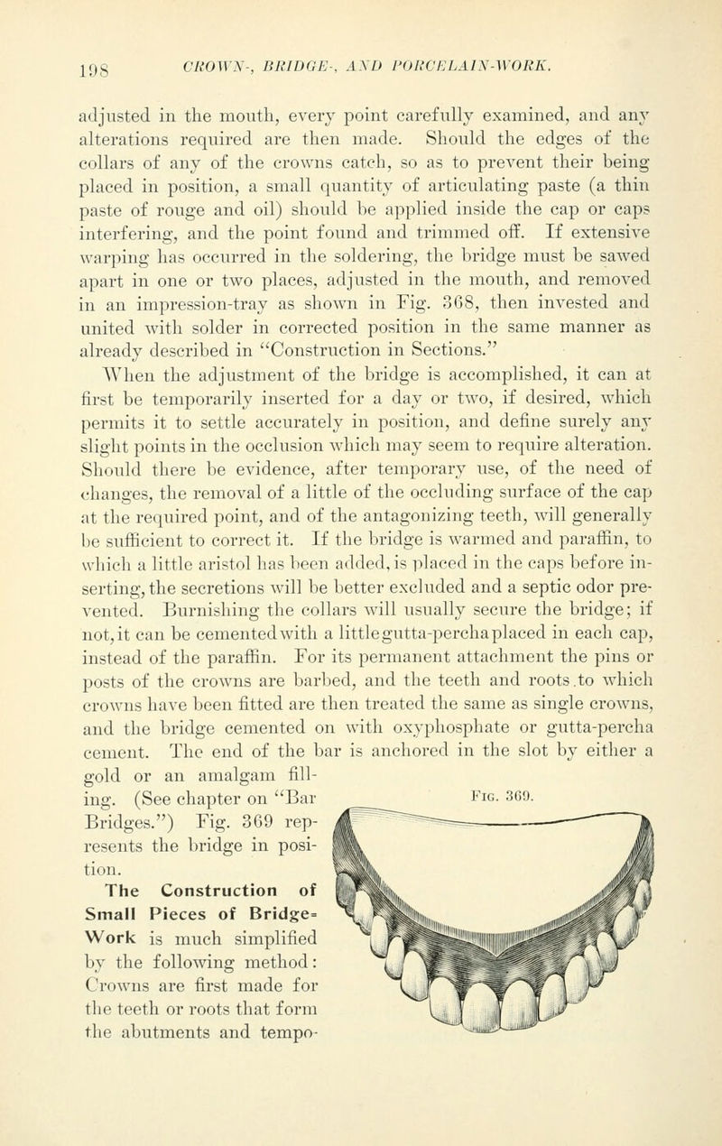 adjusted in the mouth, every point carefully examined, and any alterations required are then made. Should the edges of the collars of any of the crowns catch, so as to prevent their being- placed in position, a small quantity of articulating paste (a thin paste of rouge and oil) should be applied inside the cap or caps interfering, and the point found and trimmed off. If extensive warping has occurred in the soldering, the bridge must be sawed apart in one or two places, adjusted in the mouth, and removed in an impression-tray as shown in Fig. 368, then invested and united with solder in corrected position in the same manner as already described in Construction in Sections. When the adjustment of the bridge is accomplished, it can at first be temporarily inserted for a day or two, if desired, which permits it to settle accurately in position, and define surely any slight points in the occlusion which may seem to require alteration. Should there be evidence, after temporary use, of the need of changes, the removal of a little of the occluding surface of the cap at the required point, and of the antagonizing teeth, will generally be sufficient to correct it. If the bridge is warmed and paraffin, to which a little aristol has been added, is placed in the caps before in- serting, the secretions will be better excluded and a septic odor pre- vented. Burnishing the collars will usually secure the bridge; if not, it can be cemented with a little gutta-percha placed in each cap, instead of the paraffin. For its permanent attachment the pins or posts of the crowns are barbed, and the teeth and roots.to which crowns have been fitted are then treated the same as single crowns, and the bridge cemented on with oxyphosphate or gutta-percha cement. The end of the bar is anchored in the slot by either a gold or an amalgam fill- ing. (See chapter on Bar Bridges.) Fig. 369 rep- resents the bridge in posi- tion. The Construction of Small Pieces of Bridge= Work is much simplified by the following method: Crowns are first made for the teeth or roots that form the abutments and tempo-