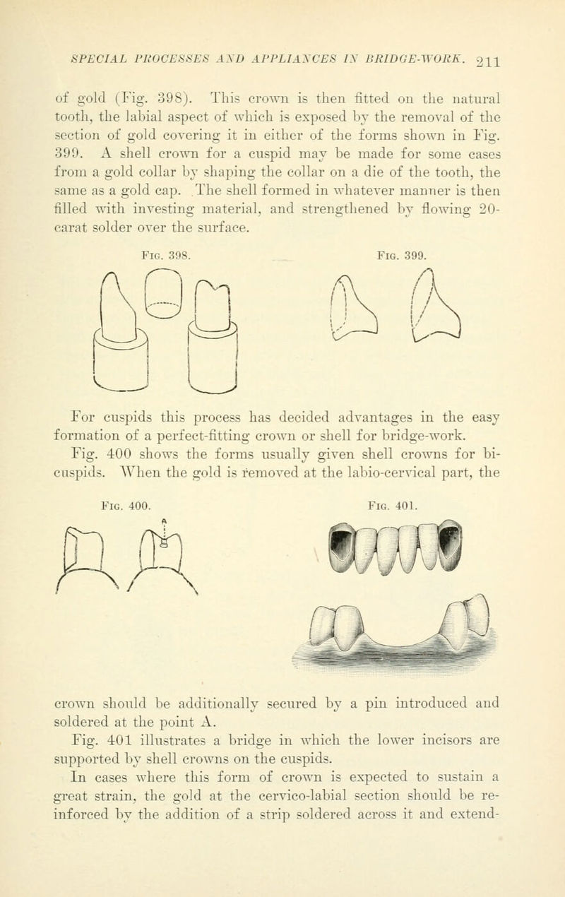 of gold (Fig. 398). This crown is then fitted on the natural tooth, the labial aspect of which is exposed by the removal of the section of gold covering it in either of the forms shown in Fig. 399. A shell crown for a cuspid may be made for some cases from a gold collar by shaping the collar on a die of the tooth, the same as a gold cap. The shell formed in whatever manner is then filled with investing material, and strengthened by flowing 20- carat solder over the surface. Fig. 398. Fig. 399. For cuspids this process has decided advantages in the easy formation of a perfect-fitting crown or shell for bridge-work. Fig. 400 shows the forms usually given shell crowns for bi- cuspids. When the gold is removed at the labio-cervical part, the Fig. 400. Fig. 401. crown should be additionally secured by a pin introduced and soldered at the point A. Fig. 401 illustrates a bridge in which the lower incisors are supported by shell crowns on the cuspids. In cases where this form of crown is expected to sustain a great strain, the gold at the cervico-labial section should be re- inforced by the addition of a strip soldered across it and extend-