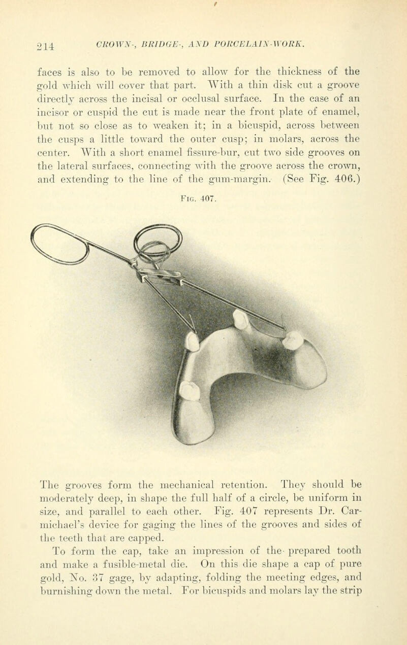 faces is also to be removed to allow for the thickness of the gold which will cover that part. With a thin disk cut a groove directly across the incisal or occlusal surface. In the case of an incisor or cuspid the cut is made near the front plate of enamel, but not so close as to weaken it; in a bicuspid, across between the cusps a little toward the outer cusp; in molars, across the center. With a short enamel fissure-bur, cut two side grooves on the lateral surfaces, connecting with the groove across the crown, and extending to the line of the gum-margin. (See Fig. 406.) Fig. 407. The grooves form the mechanical retention. They should be moderately deep, in shape the full half of a circle, be uniform in size, and parallel to each other. Fig. 407 represents Dr. Car- michael's device for gaging the lines of the grooves and sides of the teeth that are capped. To form the cap, take an impression of the- prepared tooth and make a fusible-metal die. On this die shape a cap of pure gold, No. 37 gage, by adapting, folding the meeting edges, and burnishing down the metal. For bicuspids and molars lay the strip