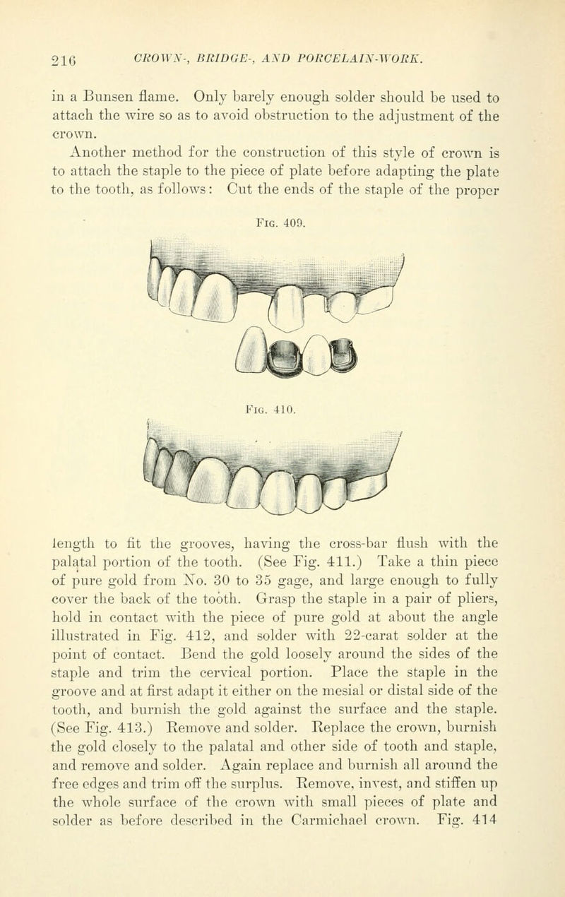 in a Bunsen flame. Only barely enough solder should be used to attach the wire so as to avoid obstruction to the adjustment of the crown. Another method for the construction of this style of crown is to attach the staple to the piece of plate before adapting the plate to the tooth, as follows: Cut the ends of the staple of the proper Fig. 409. Fig. 410. length to fit the grooves, having the cross-bar flush with the palatal portion of the tooth. (See Fig. 411.) Take a thin piece of pure gold from jSTo. 30 to 35 gage, and large enough to fully cover the back of the tooth. Grasp the staple in a pair of pliers, hold in contact with the piece of pure gold at about the angle illustrated in Fig. 412, and solder with 22-carat solder at the point of contact. Bend the gold loosely around the sides of the staple and trim the cervical portion. Place the staple in the groove and at first adapt it either on the mesial or distal side of the tooth, and burnish the gold against the surface and the staple. (See Fig. 413.) Remove and solder. Replace the crown, burnish the gold closely to the palatal and other side of tooth and staple, and remove and solder. Again replace and burnish all around the free edges and trim off the surplus. Remove, invest, and stiffen up the whole surface of the crown with small pieces of plate and solder as before described in the Carmichael crown. Fig. 414