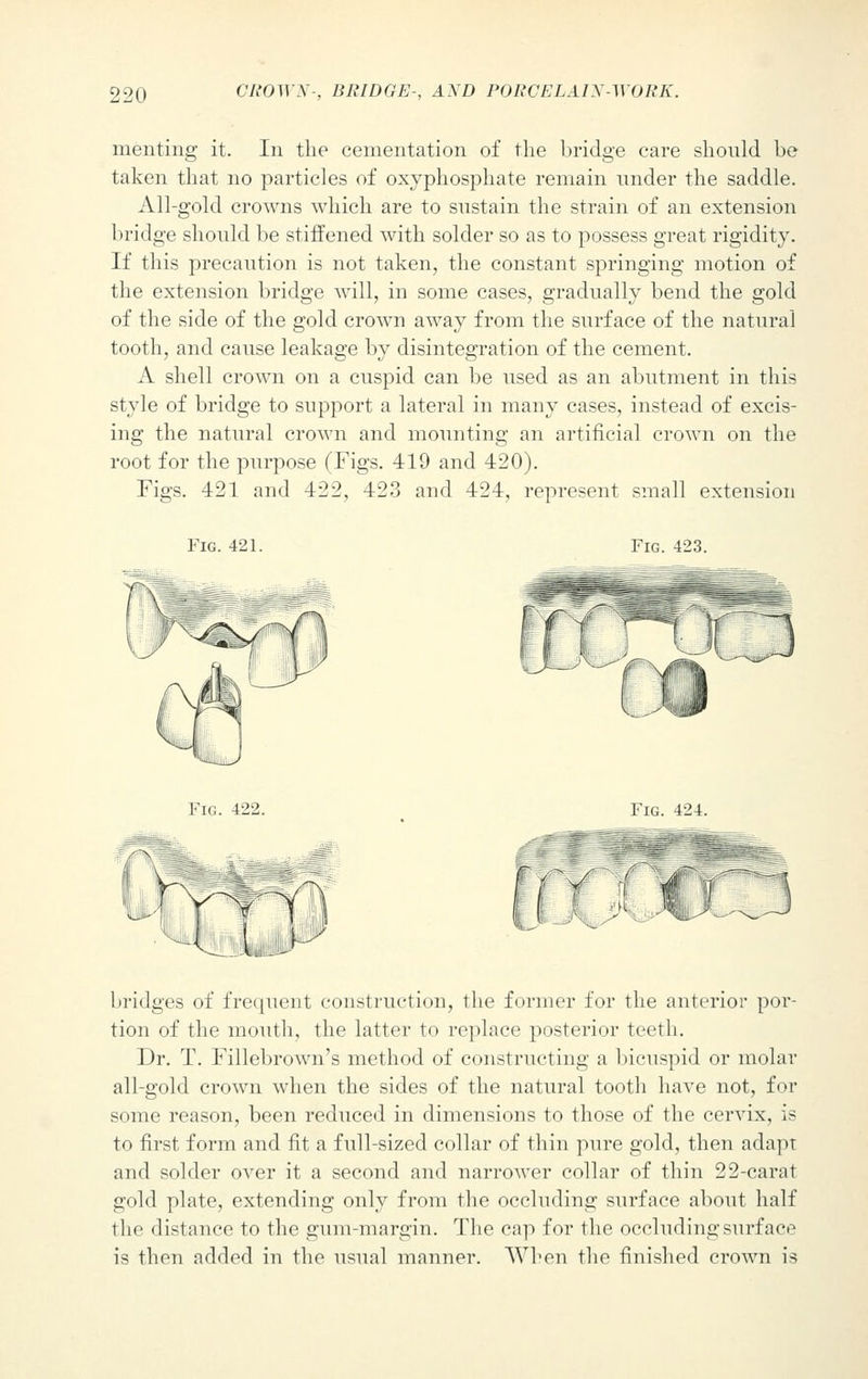 menting it. In the cementation of the bridge care should be taken that no particles of oxyphosphate remain under the saddle. All-gold crowns which are to sustain the strain of an extension bridge should be stiffened with solder so as to possess great rigidity. If this precaution is not taken, the constant springing motion of the extension bridge will, in some cases, gradually bend the gold of the side of the gold crown away from the surface of the natural tooth, and cause leakage by disintegration of the cement. A shell crown on a cuspid can be used as an abutment in this style of bridge to support a lateral in many cases, instead of excis- ing the natural crown and mounting an artificial crown on the root for the purpose (Figs. 419 and 420). Figs. 421 and 422, 423 and 424, represent small extension Fig. 421. Fig. 423. Fig. 422. Fig. 424. bridges of frequent construction, the former for the anterior por- tion of the mouth, the latter to replace posterior teeth. Dr. T. Fillebrown's method of constructing a bicuspid or molar all-gold crown when the sides of the natural tooth have not, for some reason, been reduced in dimensions to those of the cervix, is to first form and fit a full-sized collar of thin pure gold, then adapt and solder over it a second and narrower collar of thin 22-carat gold plate, extending only from the occluding surface about half the distance to the gum-margin. The cap for the occluding surface is then added in the usual manner. When the finished crown is