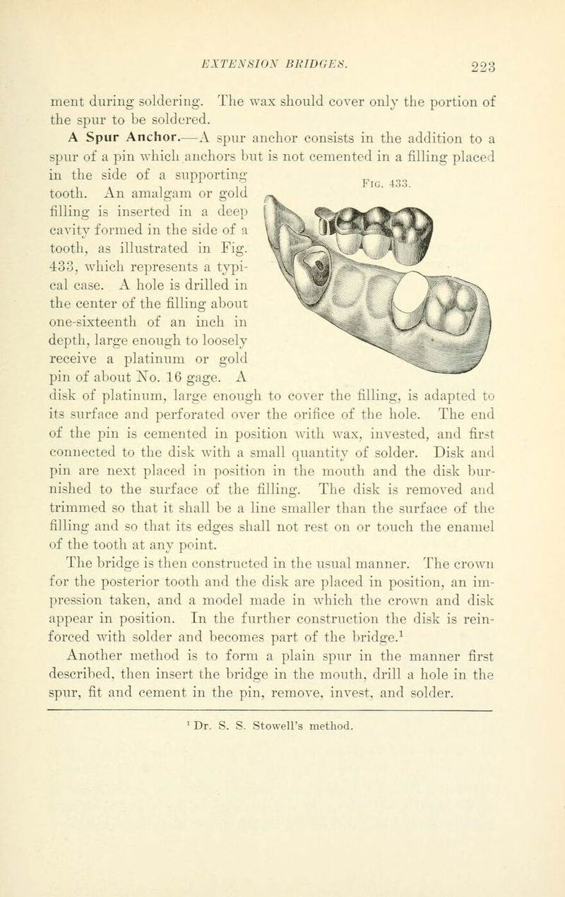 EXTENSION BR IDC I. S. merit during soldering. The wax should cover only the portion of the spur to be soldered. A Spur Anchor.—A spur anchor consists in the addition to a spur of a pin which anchors but is not cemented in a filling placed in the side of a supporting tooth. An amalgam or gold filling is inserted in a deep cavity formed in the side of a tooth, as illustrated in Fig. 433, which represents a typi- cal case. A hole is drilled in the center of the filling about one-sixteenth of an inch in depth, large enough to loosely receive a platinum or gold pin of about ISTo. 16 gage. A disk of platinum, large enough to cover the filling, is adapted to its surface and perforated over the orifice of the hole. The end of the pin is cemented in position with wax, invested, and first connected to the disk with a small quantity of solder. Disk and pin are next placed in position in the mouth and the disk bur- nished to the surface of the filling. The disk is removed and trimmed so that it shall be a line smaller than the surface of the filling and so that its edges shall not rest on or touch the enamel of the tooth at any point. The bridge is then constructed in the usual manner. The crown for the posterior tooth and the disk are placed in position, an im- pression taken, and a model made in which the crown and disk appear in position. In the further construction the disk is rein- forced with solder and becomes part of the bridge.1 Another method is to form a plain spur in the manner first described, then insert the bridge in the mouth, drill a hole in the spur, fit and cement in the pin, remove, invest, and solder. 1 Dr. S. S. Stowell's method.