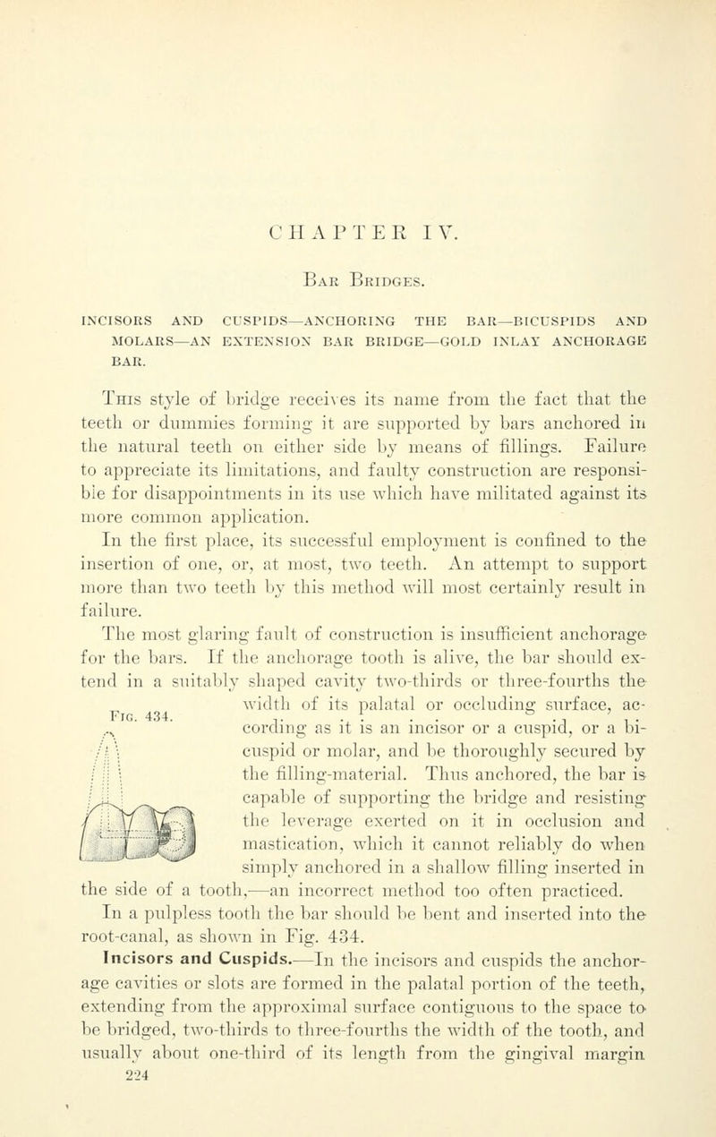 Bar Bridges. incisors and cuspids—anchoring the bar—bicuspids and molars—an extension bar bridge—gold inlay anchorage BAR. This style of bridge receives its name from the fact that the teeth or dummies forming it are supported by bars anchored in the natural teeth on either side by means of fillings. Failure to appreciate its limitations, and faulty construction are responsi- ble for disappointments in its use which have militated against its more common application. In the first place, its successful employment is confined to the insertion of one, or, at most, two teeth. An attempt to support more than two teeth by this method will most certainly result in failure. The most glaring fault of construction is insufficient anchorage for the bars. If the anchorage tooth is alive, the bar should ex- tend in a suitably shaped cavity two-thirds or three-fourths the width of its palatal or occluding surface, ac- Fig. 434. ... . ..N cording as it is an incisor or a cuspid, or a bi- cuspid or molar, and be thoroughly secured by the filling-material. Thus anchored, the bar is Ml! capable of supporting the bridge and resisting / \[\f \L -.1 the leverage exerted on it in occlusion and / : F J mastication, which it cannot reliably do when simply anchored in a shallow filling inserted in the side of a tooth,—an incorrect method too often practiced. In a pulpless tooth the bar should be bent and inserted into the root-canal, as shown in Fig. 434. Incisors and Cuspids.—In the incisors and cuspids the anchor- age cavities or slots are formed in the palatal portion of the teeth, extending from the approximal surface contiguous to the space to be bridged, two-thirds to three-fourths the width of the tooth, and usually about one-third of its length from the gingival margin