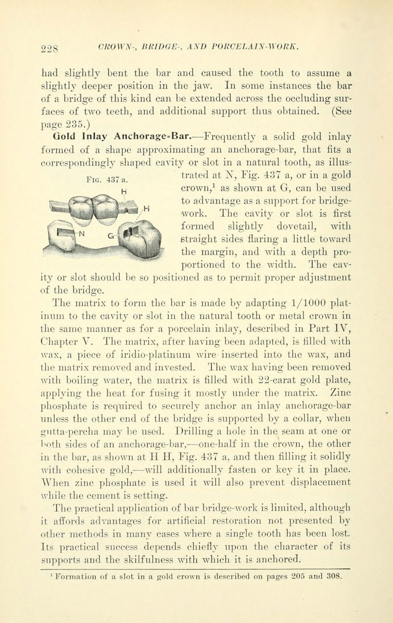 had slightly bent the bar and caused the tooth to assume a slightly deeper position in the jaw. In some instances the bar of a bridge of this kind can be extended across the occluding sur- faces of two teeth, and additional support thus obtained. (See page 235.) Gold Inlay Anchorage=Bar—Frequently a solid gold inlay formed of a shape approximating an anchorage-bar, that fits a correspondingly shaped cavity or slot in a natural tooth, as illus- trated at N, Fig. 437 a, or in a gold crown,1 as shown at Gr, can be used to advantage as a support for bridge- work. The cavity or slot is first formed slightly dovetail, with straight sides flaring a little toward the margin, and with a depth pro- portioned to the width. The cav- ity or slot should be so positioned as to permit proper adjustment of the bridge. The matrix to form the bar is made by adapting 1/1000 plat- inum to the cavity or slot in the natural tooth or metal crown in the same manner as for a porcelain inlay, described in Part IV, Chapter V. The matrix, after having been adapted, is filled with wax, a piece of iridio-platinum wire inserted into the wax, and the matrix removed and invested. The wax having been removed with boiling water, the matrix is filled with 22-carat gold plate, applying the heat for fusing it mostly under the matrix. Zinc phosphate is required to securely anchor an inlay anchorage-bar unless the other end of the bridge is supported by a collar, when gutta-percha may be used. Drilling a hole in the seam at one or both sides of an anchorage-bar,—one-half in the crown, the other in the bar, as shown at H H, Fig. 437 a, and then filling it solidly with cohesive gold,-—will additionally fasten or key it in place. When zinc phosphate is used it will also prevent displacement while the cement is setting. The practical application of bar bridge-work is limited, although it affords advantages for artificial restoration not presented by other methods in many cases where a single tooth has been lost. Its practical success depends chiefly upon the character of its supports and the skilfulness with which it is anchored. 1 Formation of a slot in a gold crown is described on pages 205 and 308.