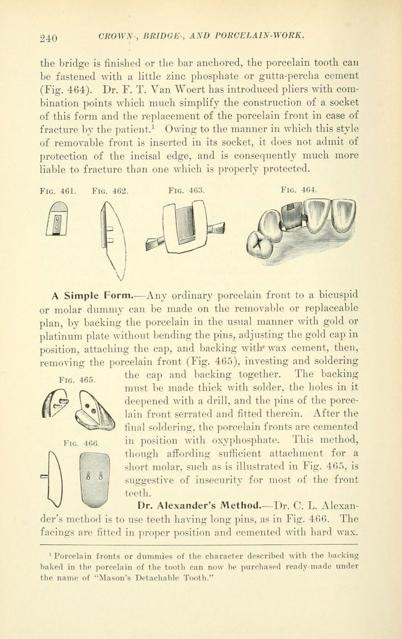 the bridge is finished or the bar anchored, the porcelain tooth can be fastened with a little zinc phosphate or gutta-percha cement (Fig. 464). Dr. F. T. Van Woert has introduced pliers with com- bination points which much simplify the construction of a socket of this form and the replacement of the porcelain front in case of fracture by the patient.1 Owing to the manner in which this style of removable front is inserted in its socket, it does not admit of protection of the incisal edge, and is consequently much more liable to fracture than one which is properly protected. Fig. 461. Fig. 462. Fig. 463. Fig. 464. Fig. 465. A Simple Form.—Any ordinary porcelain front to a bicuspid or molar dummy can be made on the removable or replaceable plan, by backing the porcelain in the usual manner with gold or platinum plate without bending the pins, adjusting the gold cap in position, attaching the cap, and backing with* wax cement, then, removing the porcelain front (Fig. 465), investing and soldering the cap and backing together. The backing must be made thick with solder, the holes in it deepened with a drill, and the pins of the porce- lain front serrated and fitted therein. After the final soldering, the porcelain fronts are cemented in position with oxyphosphate. This method, though affording sufficient attachment for a short molar, such as is illustrated in Fig. 465, is suggestive of insecurity for most of the front teeth. Dr. Alexander's Methods—Dr. C. L. Alexan- der's method is to use teeth having long pins, as in Fig. 466. The facings are fitted in proper position and cemented with hard wax. Porcelain fronts or dummies of the character described with the backing baked in the porcelain of the tooth can now be purchased ready-made under the name of Mason's Detachable Tooth. Fig. 466.