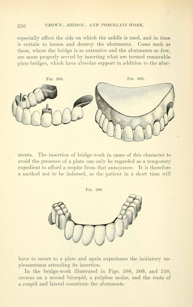 especially affect the side on which the saddle is used, and in time is certain to loosen and destroy the abutments. Cases such as these, where the bridge is so extensive and the abutments so few, are more properly served by inserting what are termed removable plate-bridges, which have alveolar support in addition to the abut- FiG. 504. Fig. 505. ments. The insertion of bridge-work in cases of this character to avoid the presence of a plate can only be regarded as a temporary expedient to afford a respite from that annoyance. It is therefore a method not to be indorsed, as the patient in a short time will Fig. 506. have to resort to a plate and again experience the initiatory un- pleasantness attending its insertion. In the bridge-work illustrated in Figs. 508, 509, and 510, crowns on a second bicuspid, a pulpless molar, and the roots of a cuspid and lateral constitute the abutments.