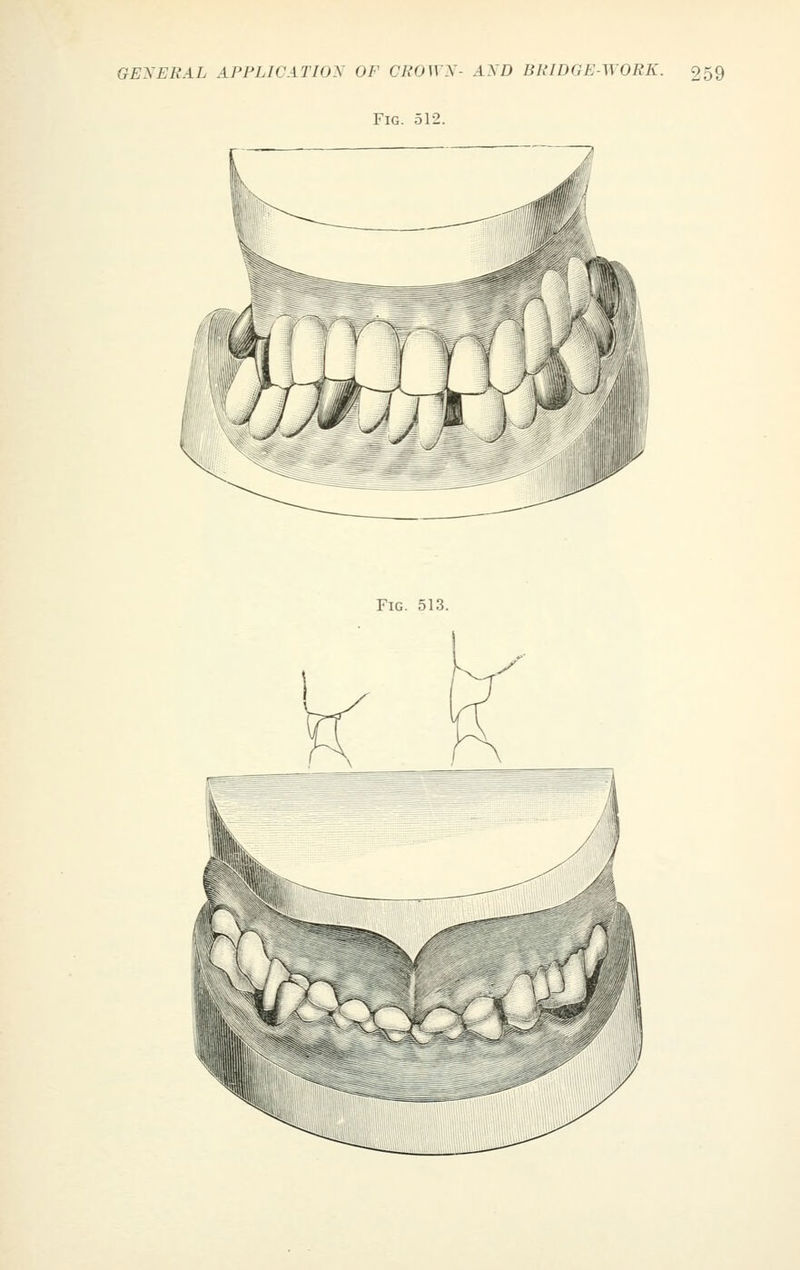 Fig. 512.
