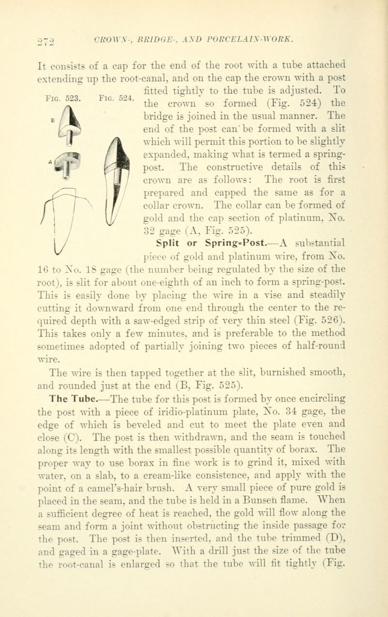 It consists of a cap for the end of the root with a tube attached extending up the root-canal, and on the cap the crown with a post fitted tightly to the tube is adjusted. To the crown so formed (Fig. 524) the Fig. bridge is joined in the usual manner. The end of the post can' be formed with a slit which will permit this portion to be slightly- expanded, making what is termed a spring- post. The constructive details of this crown are as follows: The root is first prepared and capped the same as for a collar crown. The collar can be formed of gold and the cap section of platinum. Xo. 32 gage I A. Fig. r>25). Split or Spring=Post.—A substantial of gold and platinum wire, from Xo. 10 to X. Is gage (the number being regulated by the size of the root), is slit fur about one-eighth of an inch to form a spring-post. This is easily done by placing the wire in a vise and steadily cutting it downward from one end through the center to the re- quired depth with a saw-edged strip of very thin steel (Fig. 526). This takes only a few minutes, and is preferable to the method sometimes adopted of partially joining two pieces of half-round wire. The wire is then tapped together at the slit, burnished smooth, and rounded just at the end (B, Fig. 525). The Tube—The tube for this post is formed by once encircling the post with a piece of iridio-platinum plate, Xo. 3-i gage, the edge of which is beveled and cut to meet the plate even and close (C). The post is then withdrawn, and the seam is touched along its length with the smallest possible quantity of borax. The proper way to use borax in fine work is to grind it, mixed with water, on a slab, to a cream-like consistence, and apply with the point of a cameTs-hair brush. A very small piece of pure gold is placed in the seam, and the tube is held in a Bunsen flame. When a sufficient degree of heat is reached, the gold will flow along the seam and form a joint without obstructing the inside passage for the post. The post is then inserted, and the tube trimmed CD), and gaged in a gage-plate. With a drill just the size of the tube the root-canal is enlarged so that the tube will fit tightly (Fig.